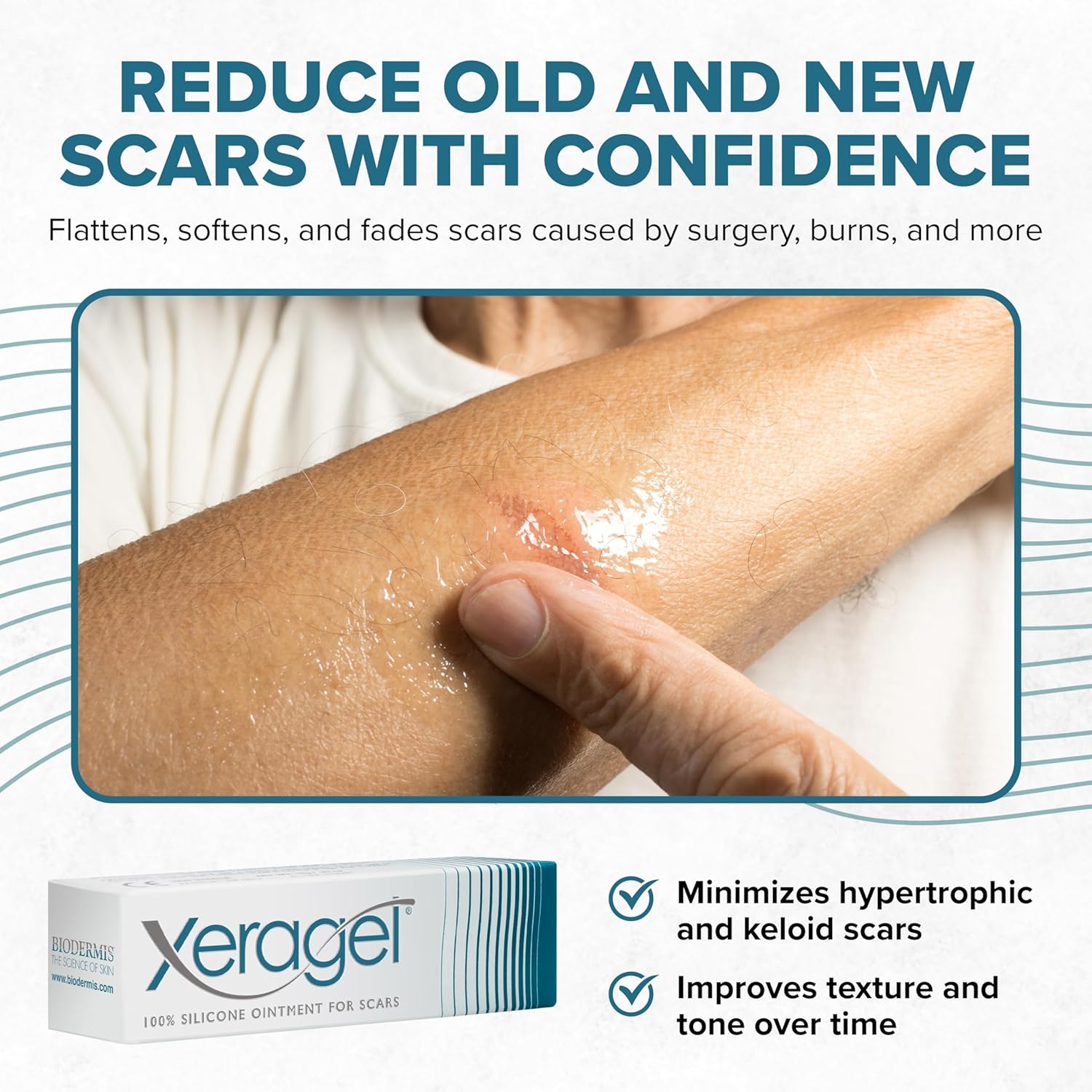 Xeragel 100% Silicone Scar Treatment Ointment 10g – Scar Gel for Smoother, Flatter Scars from Surgery, Burns, Acne & More - For Old & New Scars on Face, Neck & Hands - Hypoallergenic & Fragrance-free - Image 3