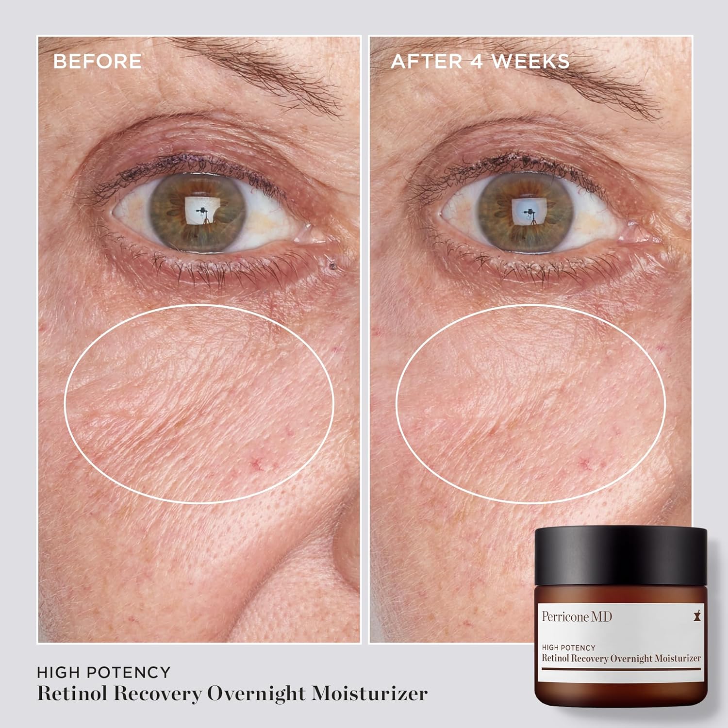 High Potency Classics Retinol Recovery Overnight Moisturizer - Image 4