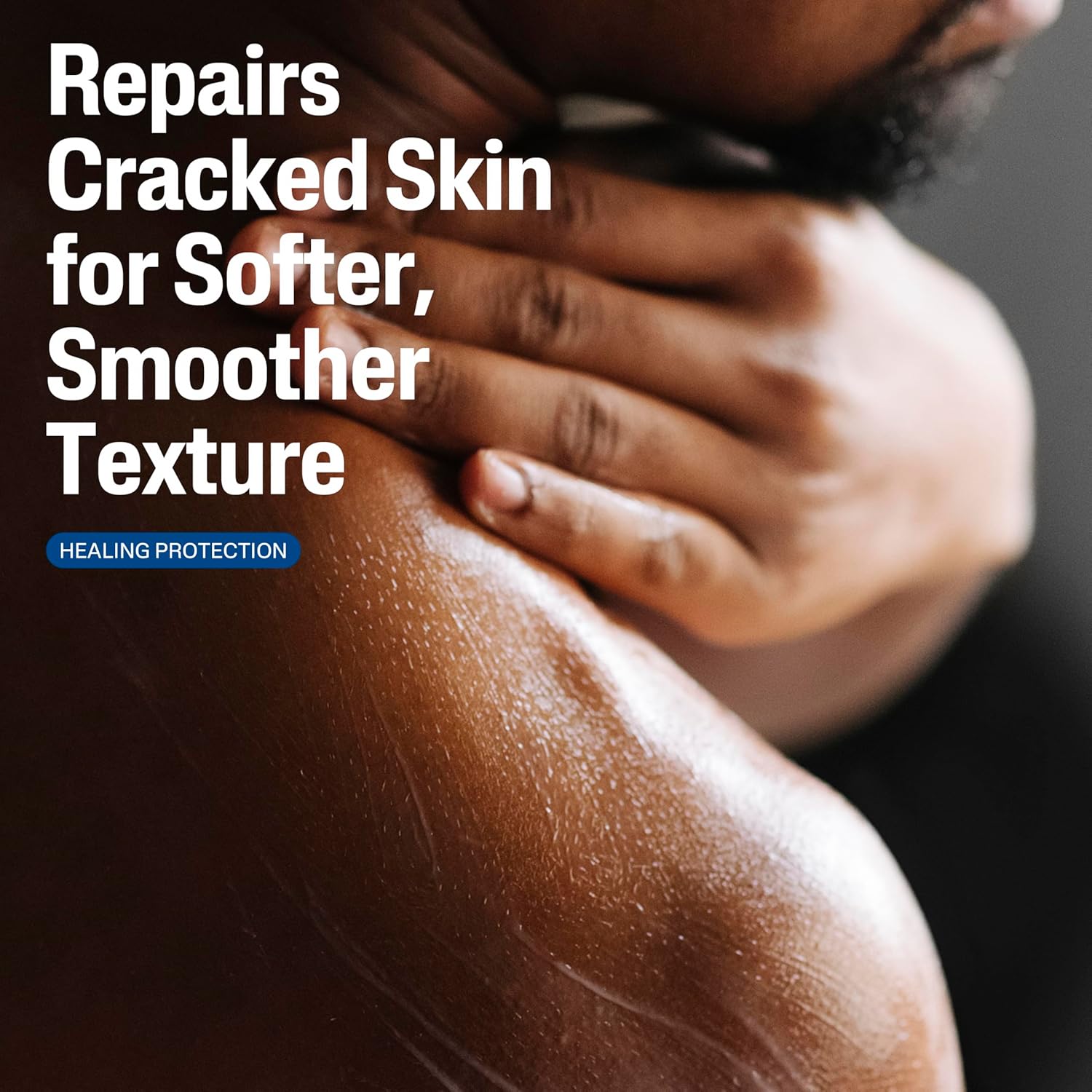 Cetaphil Cracked Skin Repair Lotion, 16 oz, For Very Rough & Cracked, Sensitive Skin, 24 Hour Hydration, Protects & Hydrates Cracked Skin, Hypoallergenic, Fragrance Free - Image 4