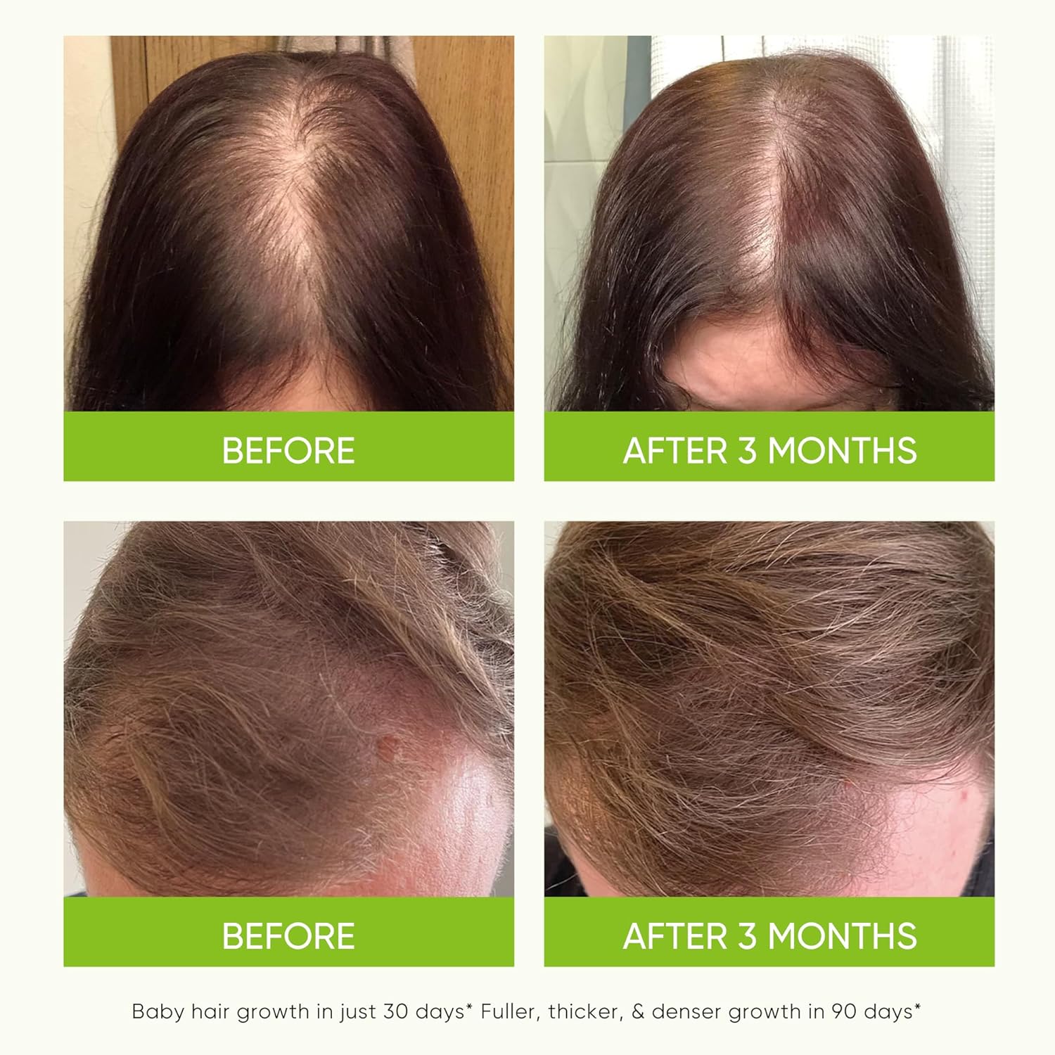 Hair Growth Serum Spray - with Rosemary Batana Oil Biotin for Hair Loss and Thinning Hair - Thicker Fuller Hair for Women Men 2 Fl Oz (Pack of 1) - Image 4