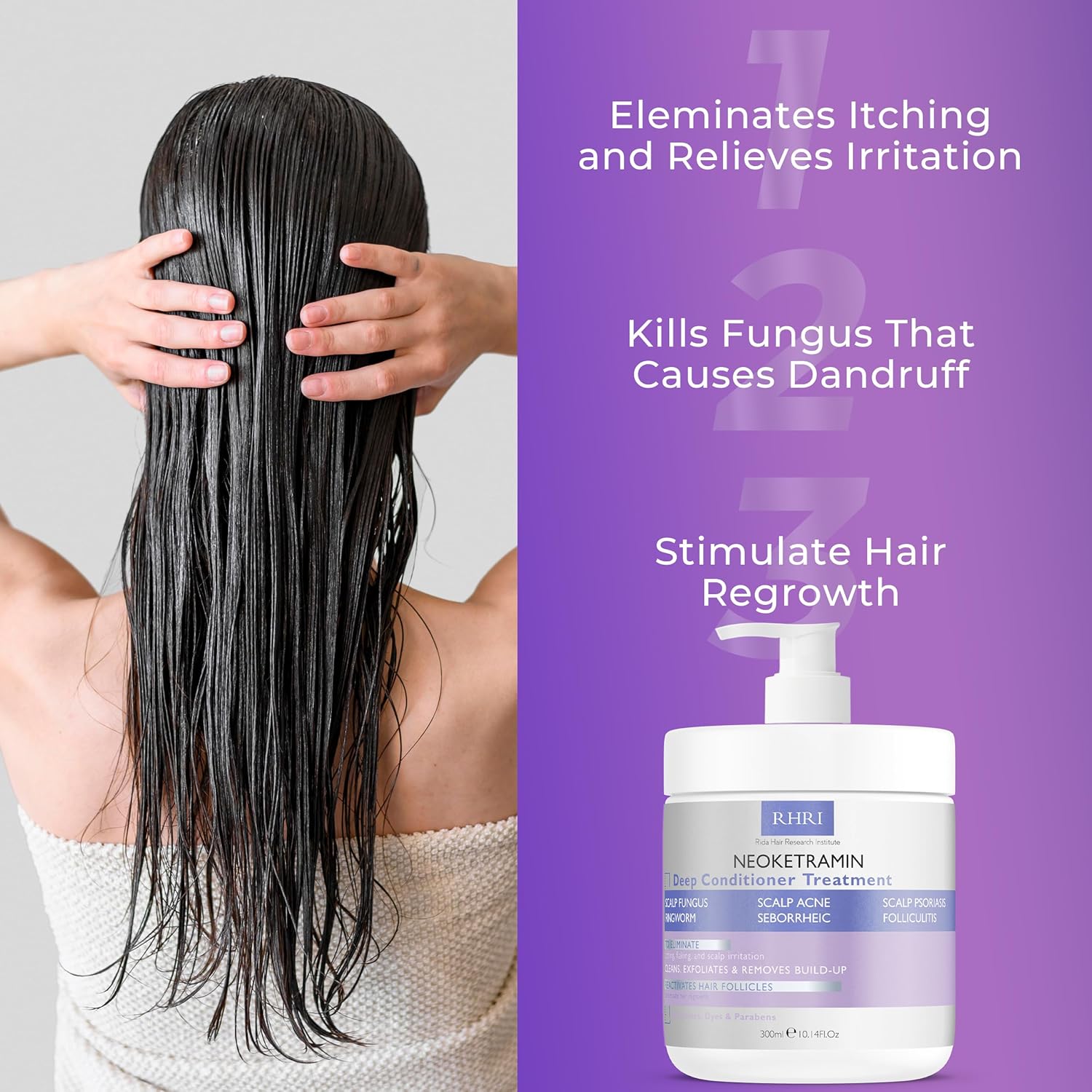 Anti Fungal Deep Conditioner for Men and Women | Scalp Treatment for Psoriasis, Dandruff, Seborrheic Dermatitis | Provides Relief from Folliculitis, Eczema, Itchy , Flaky and Dry Scalp - Image 5