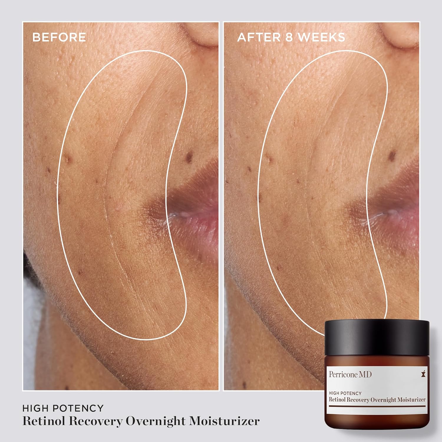 High Potency Classics Retinol Recovery Overnight Moisturizer - Image 3