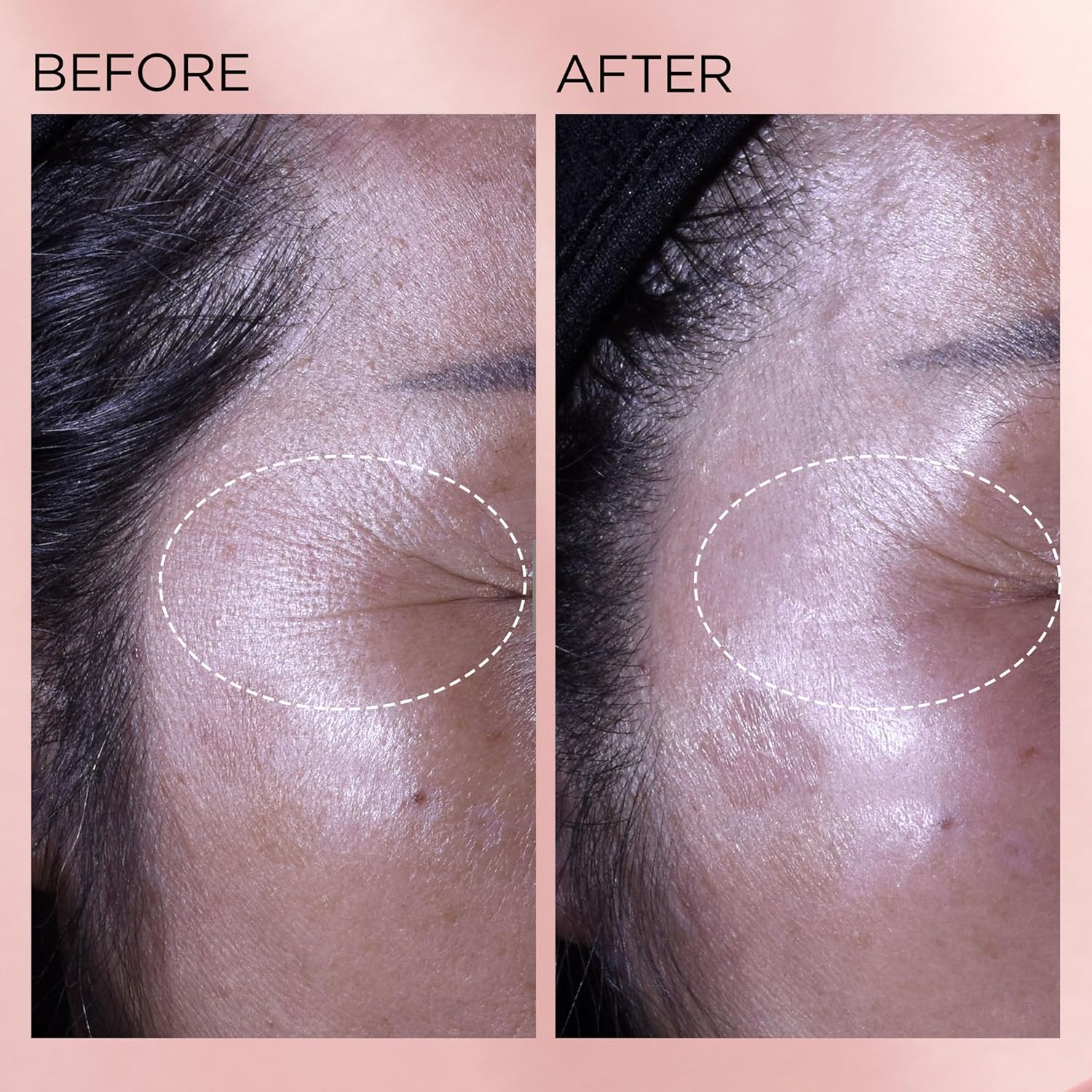 Elizabeth Arden Retinol + HPR Ceramide Capsules Rapid Skin Renewing Serum - Image 9