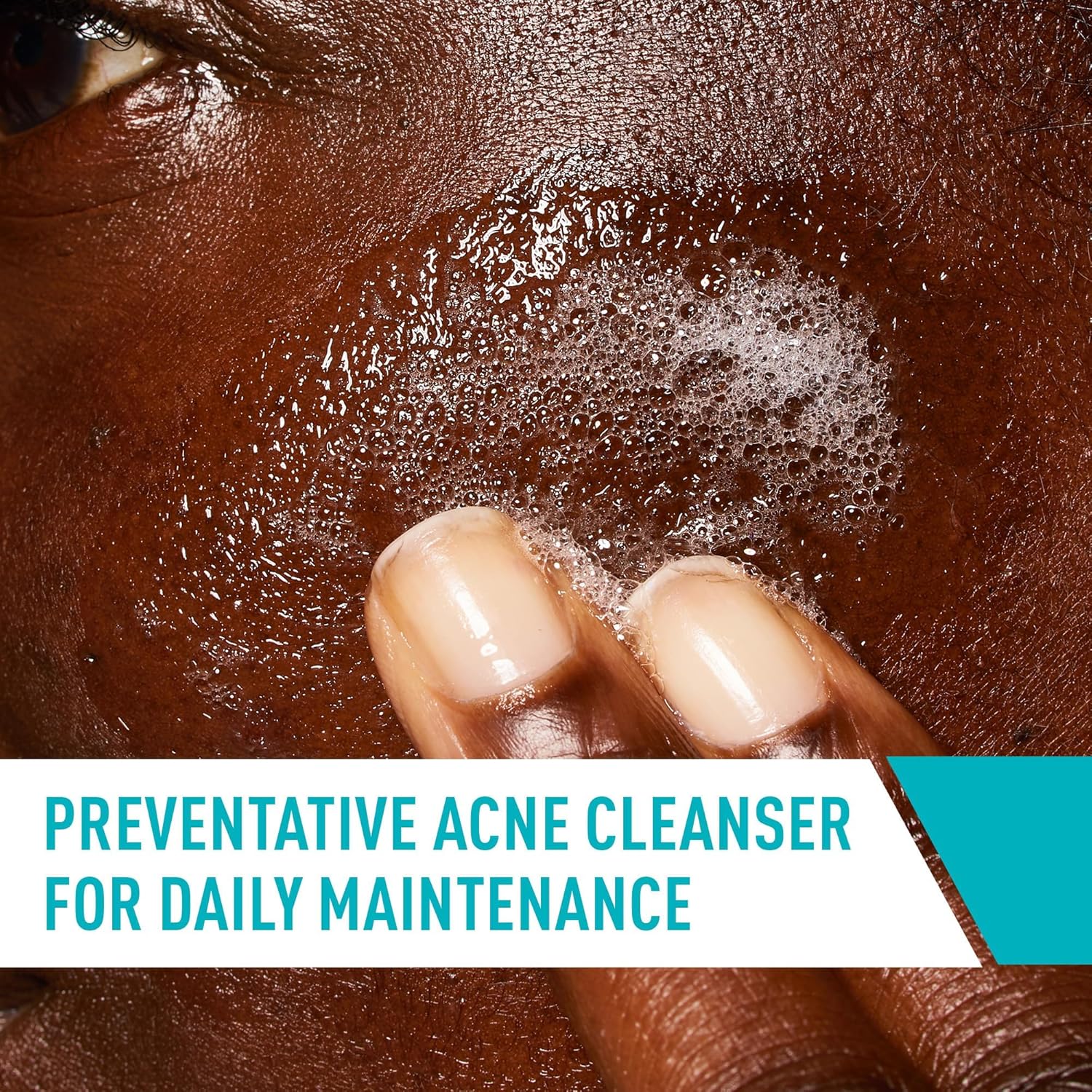 CeraVe Acne Treatment Face Wash, Salicylic Acid Cleanser with Purifying Clay, Niacinamide, and Ceramides, Pore Control and Blackhead Remover, 8 Ounce - Image 4
