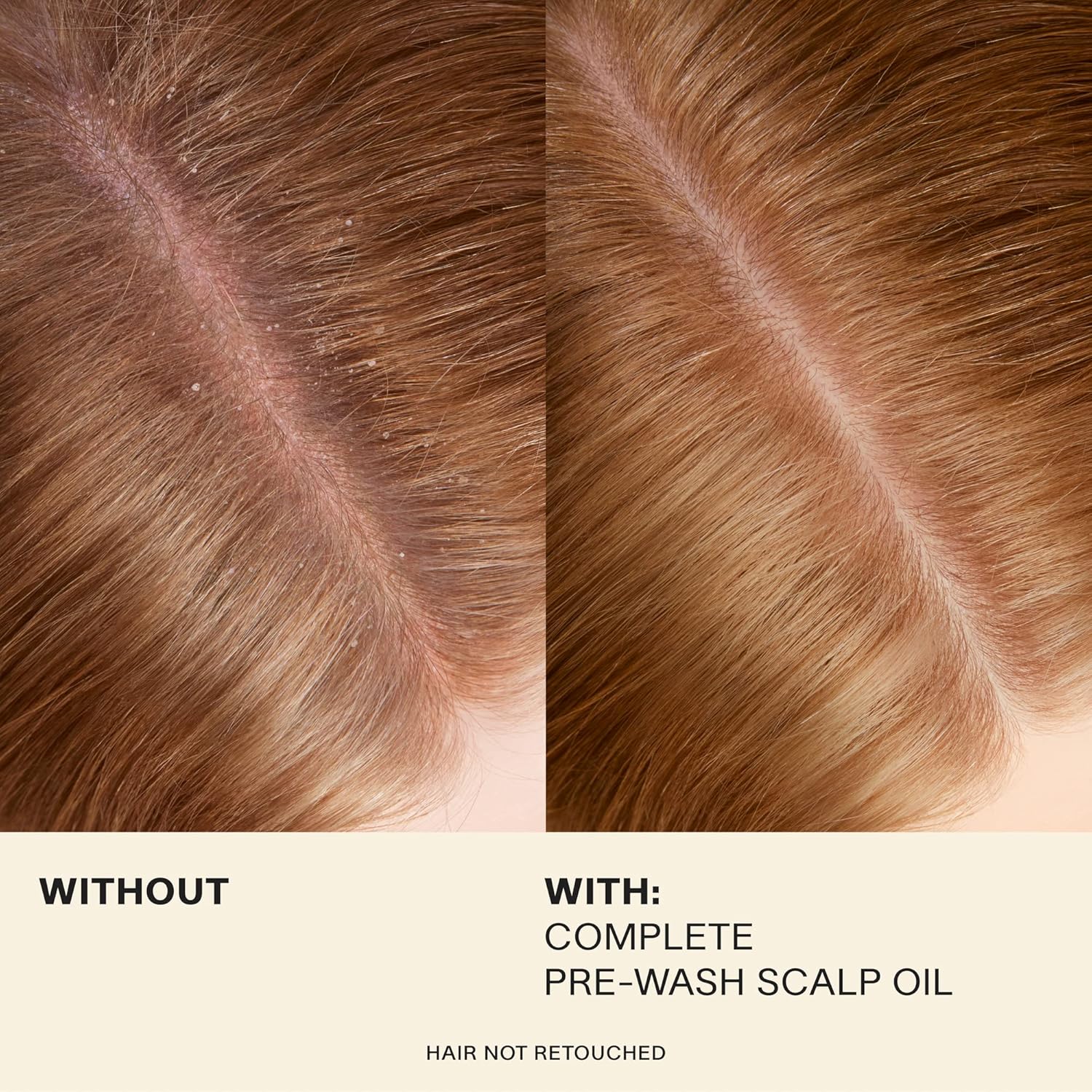 JVN Complete Hair and Scalp Oil With Rosemary, Dry Scalp and Dry Hair Oil for All Hair Types, Silicone-Free, 1.7 Fluid Ounces - Image 3