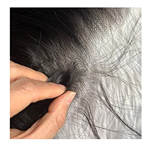 lace frontal closure