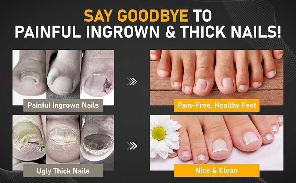 Pedicure Tools