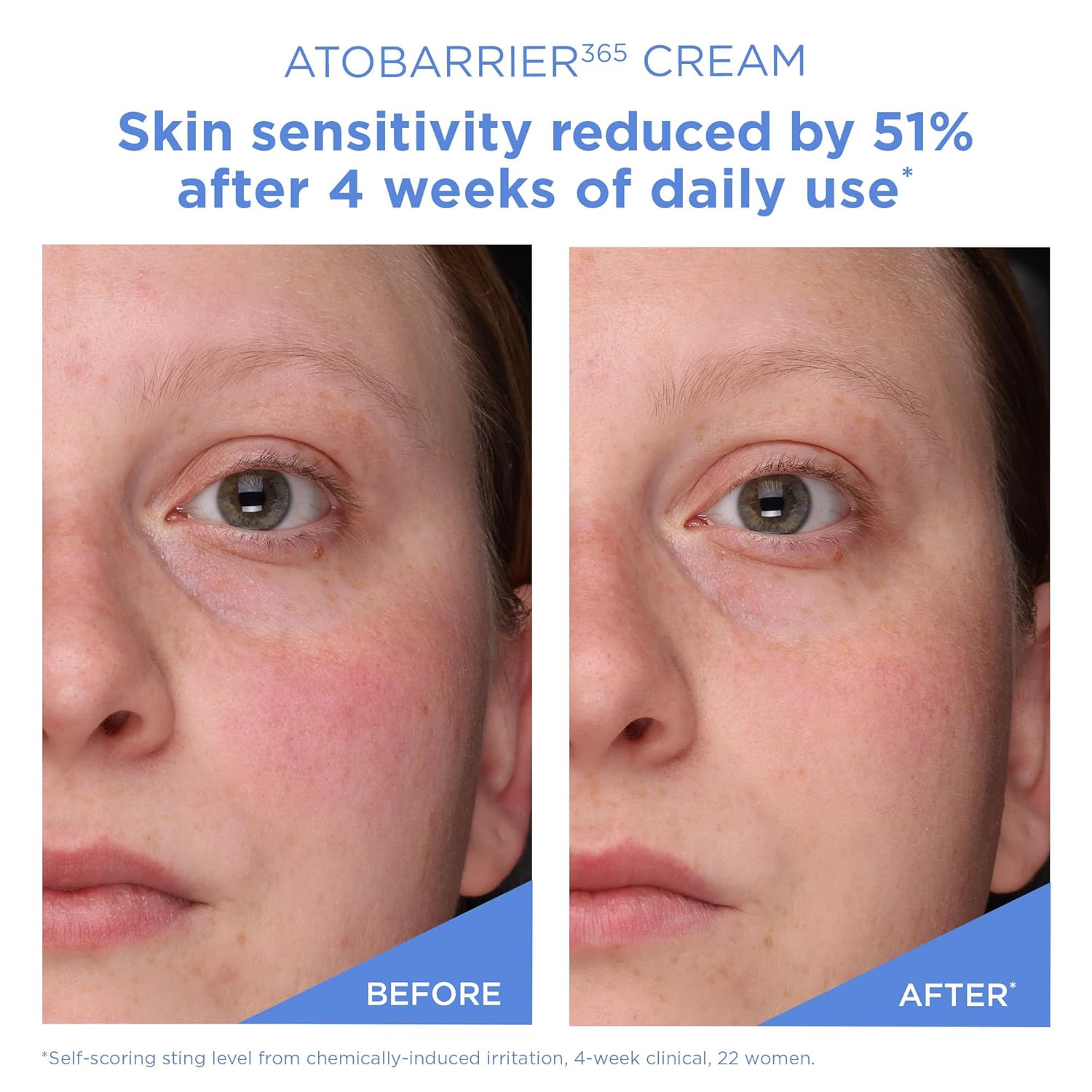 AESTURA ATOBARRIER365 Cream with Ceramides, Korean Moisturizer for Skin Barrier Repair | Long-lasting Hydration, Ceramide Capsules, Dry & Sensitive Skin, Non-comedogenic, 80 mL / 2.70 fl.oz. - Image 7