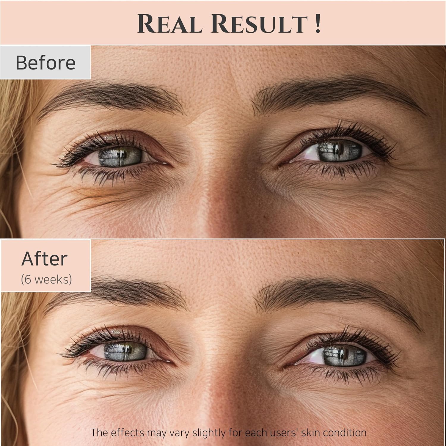 Beauty of Joseon Revive Eye Serum with Retinal Niacinamide Correction for Puffy Eye Bags Fine Lines Dark Circles Wrinkles, Korean Skin Care 30ml, 1 fl.oz - Image 3