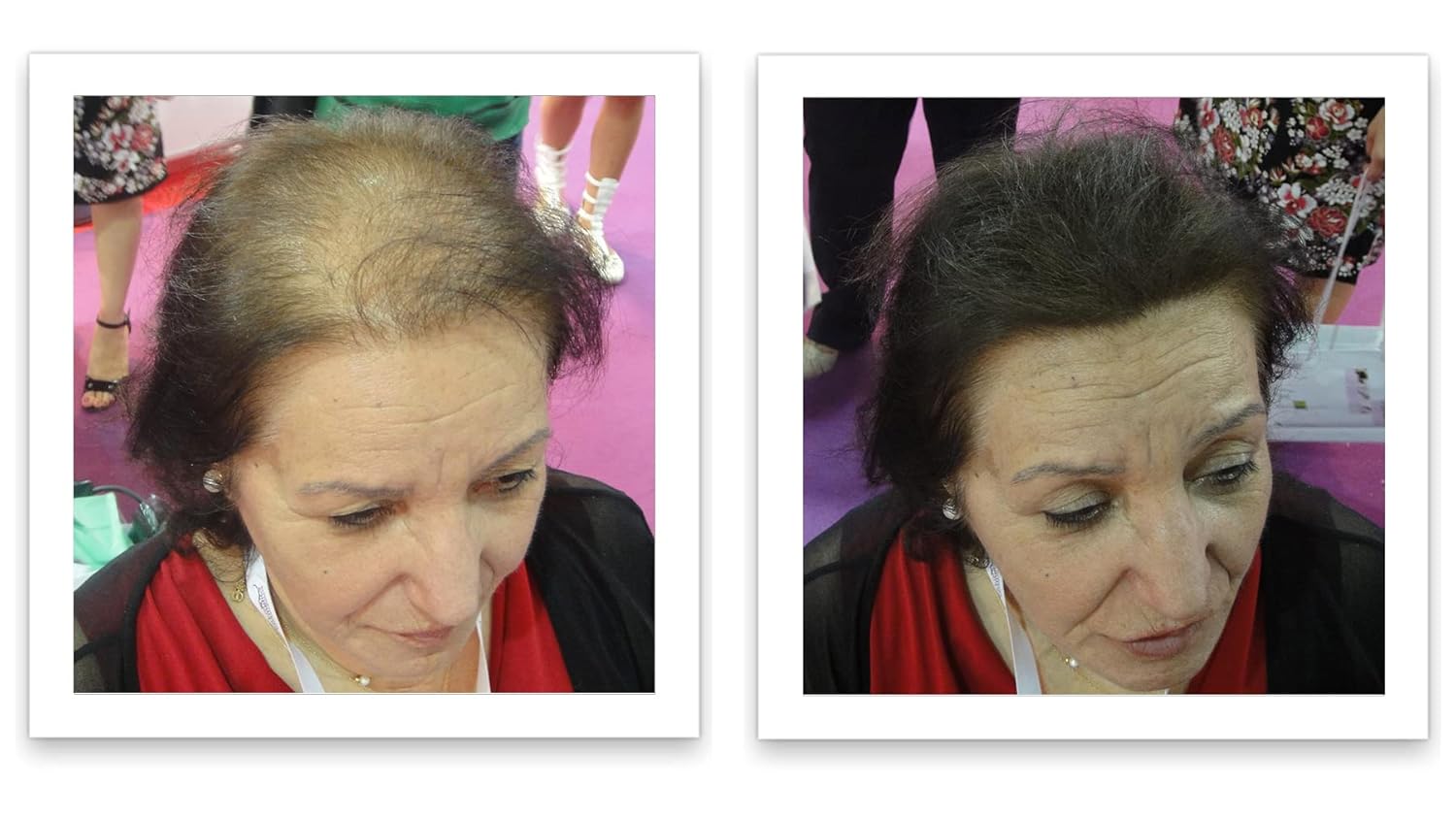 Caboki Hair Loss Concealer, 90-day supply, Dark Brown - Image 3