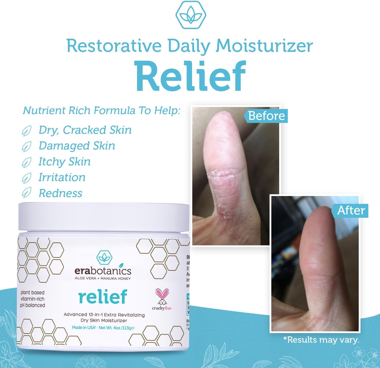 Era Organics Eczema, Psoriasis & Dermatitis Moisturizer Cream - Advanced 13-in-1 Non-Greasy Face or Body Lotion for Dry, Itchy Skin with Aloe Vera, Manuka Honey and More 4oz - Image 5