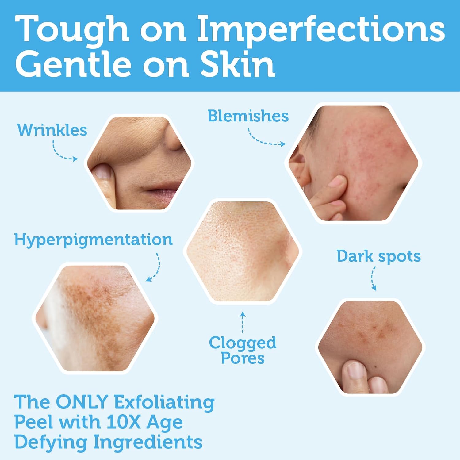 Era Organics Glycolic Acid Peel AHA BHA Exfoliant - 70% USP Grade Clinical Strength Age-Defying At Home Chemical Exfoliant for Face - Salicylic and Lactic Acid, Aloe Vera, Manuka Honey - Image 3