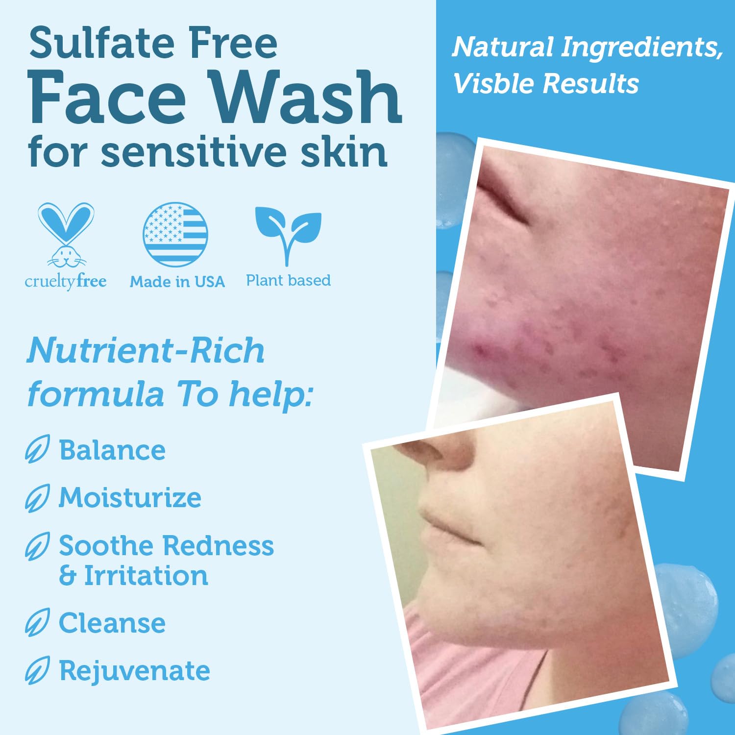 Era Organics Manuka Honey Face Wash for Women, Men - Sulfate Free Moisturizing Cleanser, Organic Aloe Vera - Soothing Plus Gentle on Dry Skin Facial Cleanser Made in USA - 8oz - Image 5