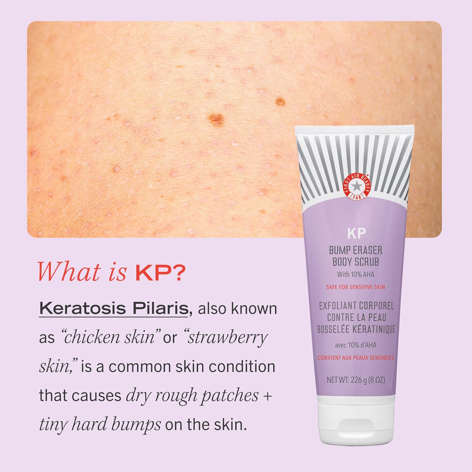 First Aid Beauty - KP Bump Eraser Body Scrub with 10% AHA, Keratosis Pilaris Skin Exfoliator with Glycolic and Lactic acids, Helps Reduce Chicken Skin Bumps, Safe for Sensitive Skin, 8 oz - Image 6