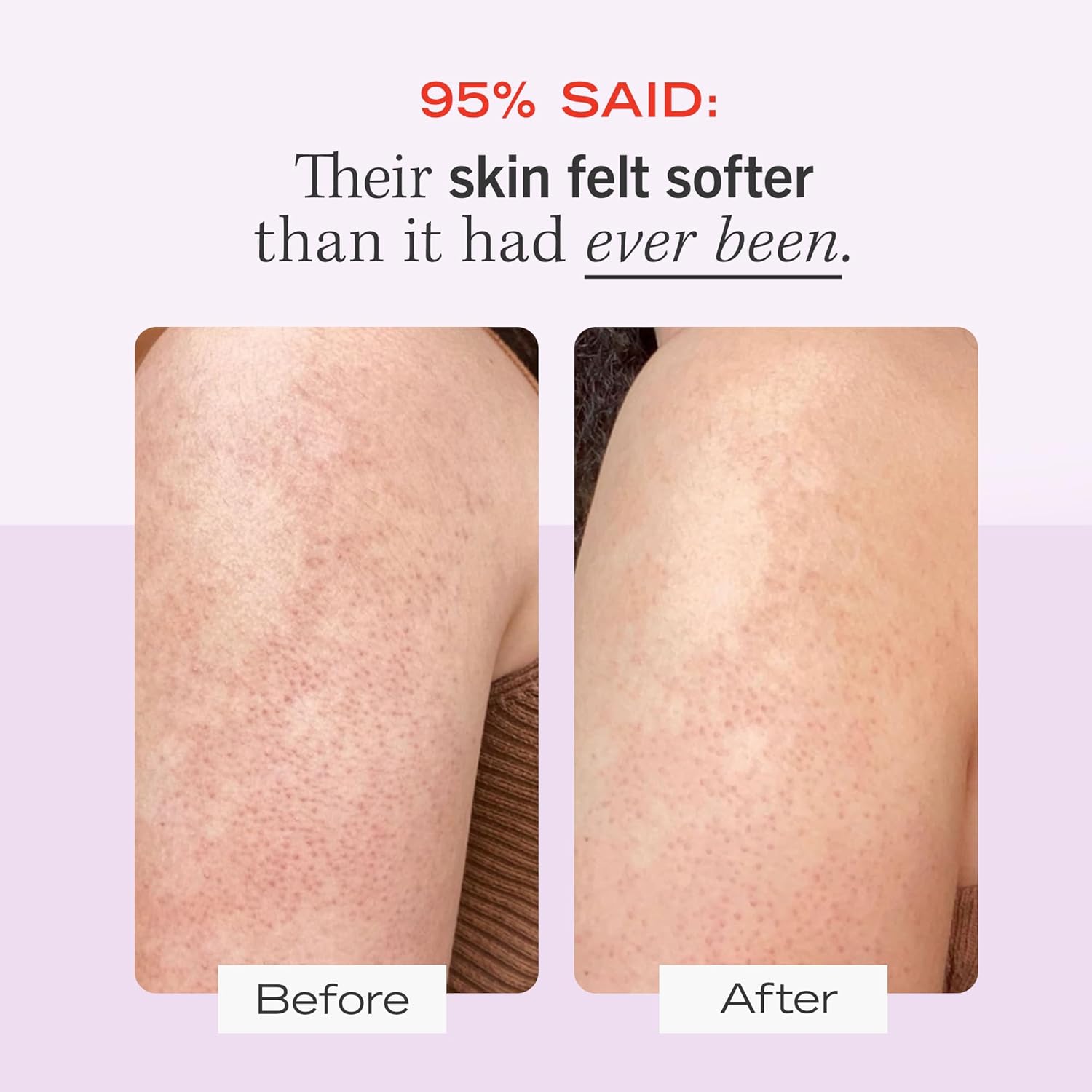 First Aid Beauty - KP Bump Eraser Body Scrub with 10% AHA, Keratosis Pilaris Skin Exfoliator with Glycolic and Lactic acids, Helps Reduce Chicken Skin Bumps, Safe for Sensitive Skin, 8 oz - Image 3