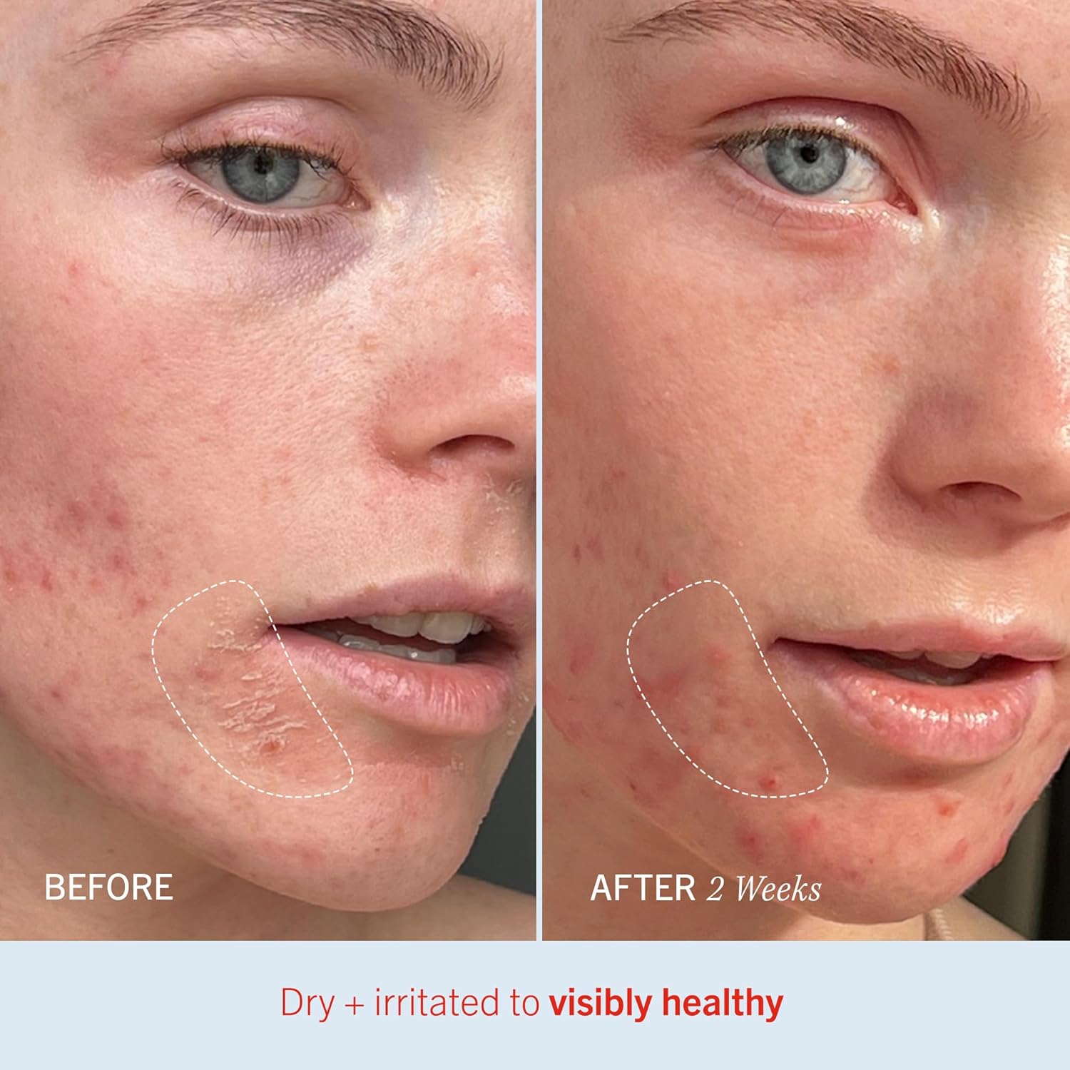 First Aid Beauty Ultra Repair Cream 6 oz 2ct Pack Intense Hydration Whipped Colloidal Oatmeal Strengthens Skin Barrier - Image 5