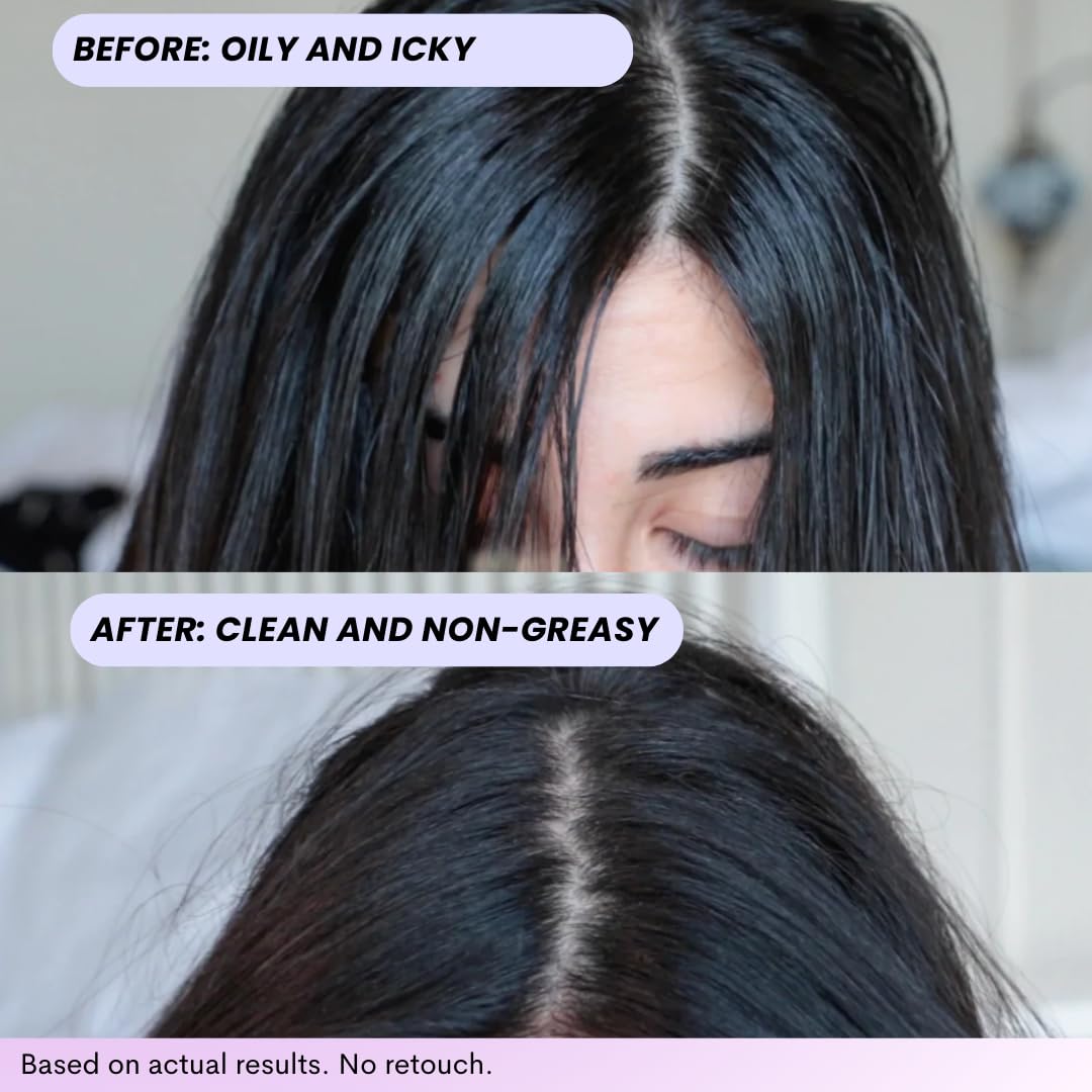 FoxyBae Turned Up Dry Shampoo - 7 Fl Oz + 12-in-1 Magic Dry Hair Mask - Hydrating Leave in Conditioner Spray - 8 Oz - Image 5
