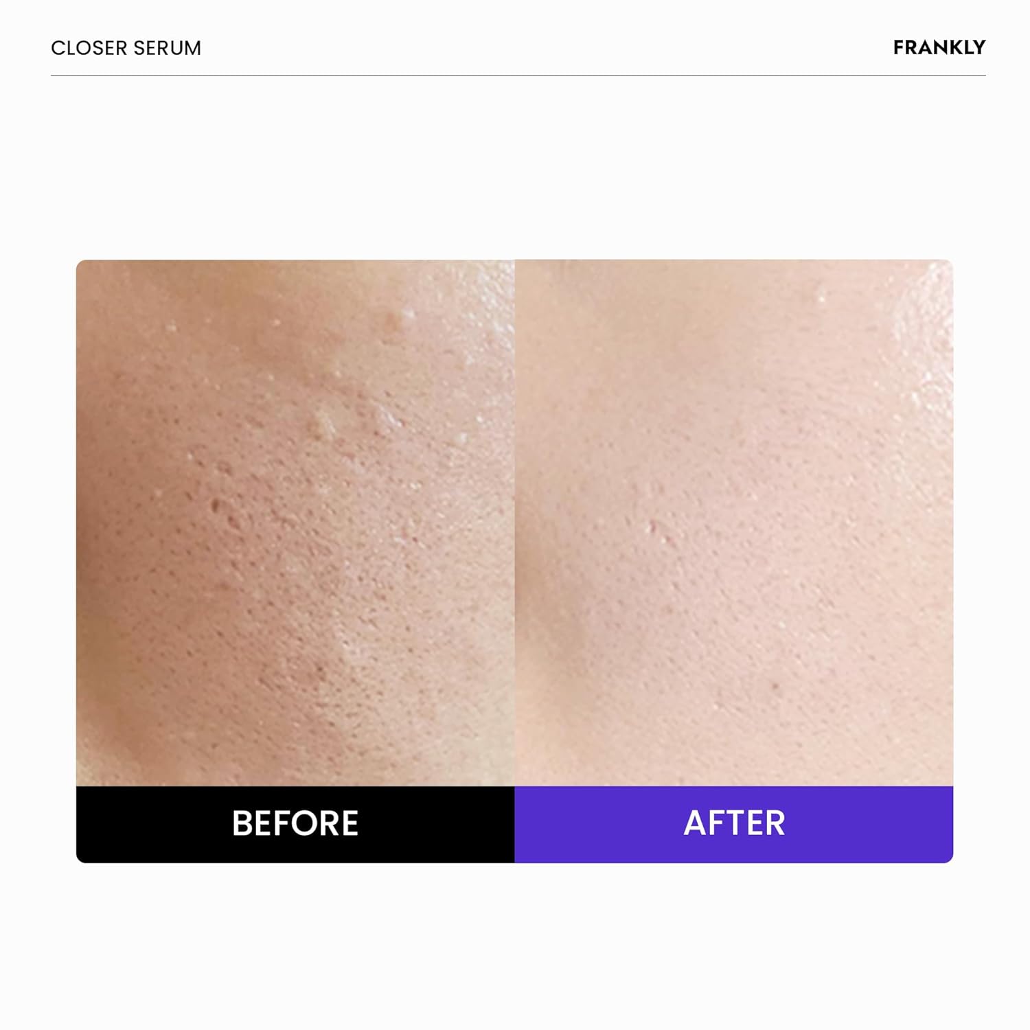 FRANKLY Closer Serum | Pore Minimizer Serum | 9 Peptides, Vegan Collagen, Adenosine, PHA | Korean Pore Minimizer for Glass Skin, Anti-Aging, Hydration, Elasticity | 1.01 fl oz - Image 2