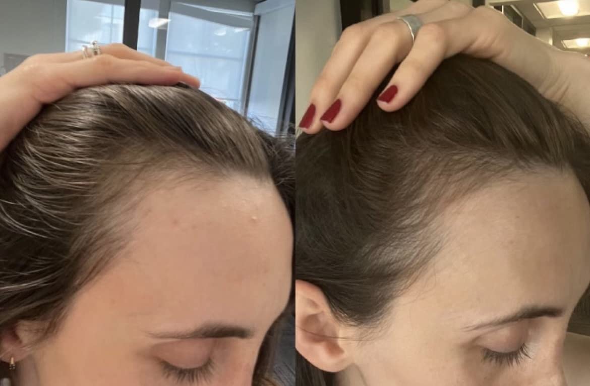 Growing Season Hair Growth And Repair Oil | With Burdock, Nettle Oil and Vitamin C for Visibly Fuller, Stronger and Shinier Hair. - Image 7