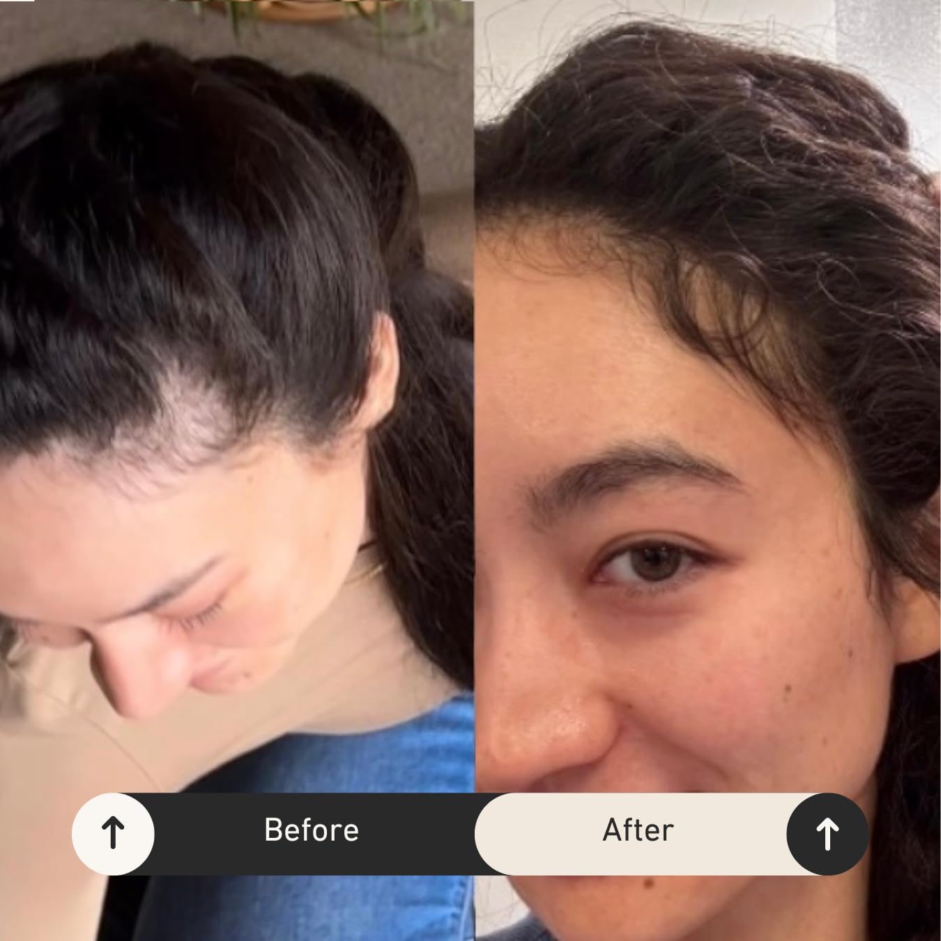 Growing Season Hair Growth And Repair Oil | With Burdock, Nettle Oil and Vitamin C for Visibly Fuller, Stronger and Shinier Hair. - Image 5