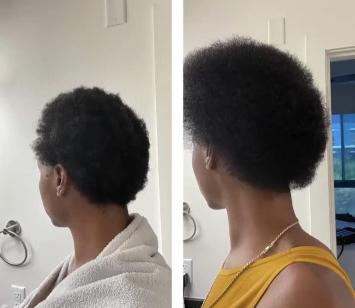 Growing Season Hair Growth And Repair Oil | With Burdock, Nettle Oil and Vitamin C for Visibly Fuller, Stronger and Shinier Hair. - Image 6
