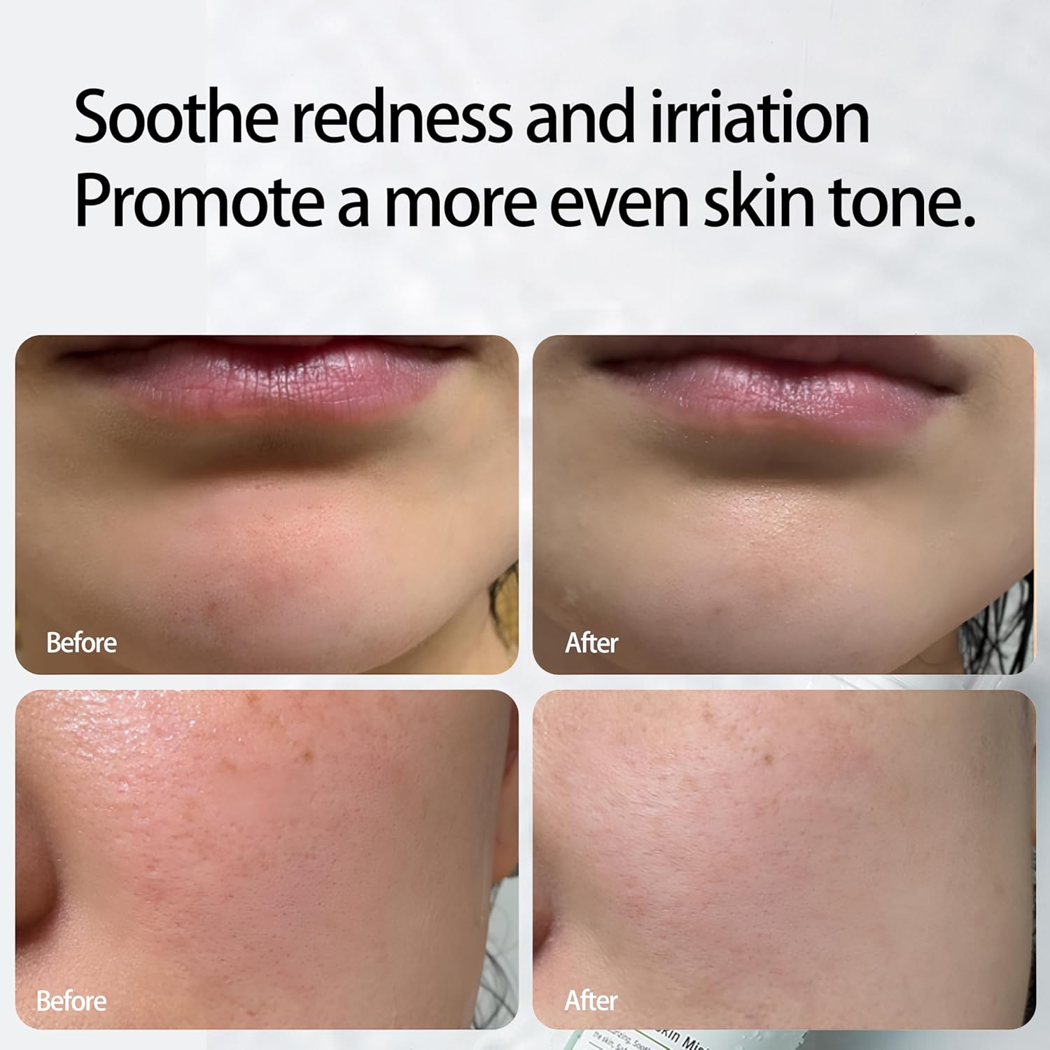 Hydrating Toner for Sensitive Skin - Facial Toner Spray - Aloe Vera and Centella Asiatica - pH Balanced Face Mist for Acne Prone Skin - Korean Skincare - CICA Facial Mist for Redness and Dryness - Image 4