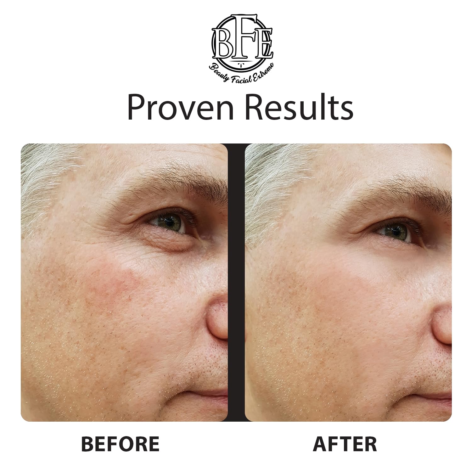 Instant Ageless Eye Cream - Reduces Under Eye Puffiness. Lift Technology to Tighten & Firm Sagging Skin Around Eyes. Works within Seconds. Smooths Away Fine Lines & Wrinkles for Men & Women. - Image 6