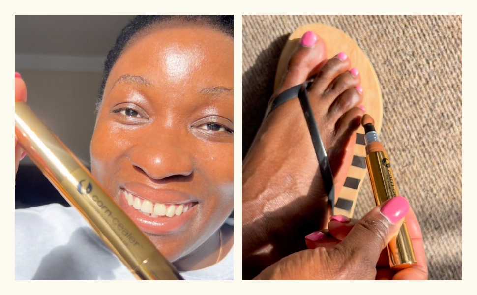 Woman holding Corn-Cealer and also applying it to her affected toes with corns.