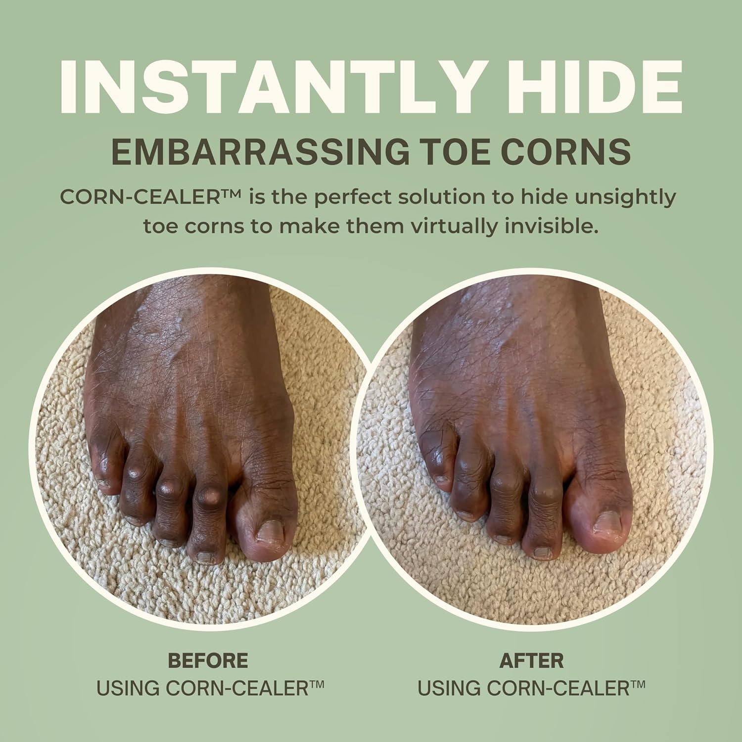 is A Toe Corn Makeup That Instantly Hides Toe Corns | Water-Resistant | Foot Care | Body and Scar Blemishes | Tattoo Cover up | Gifts for Her (NUTMEG) - Image 2