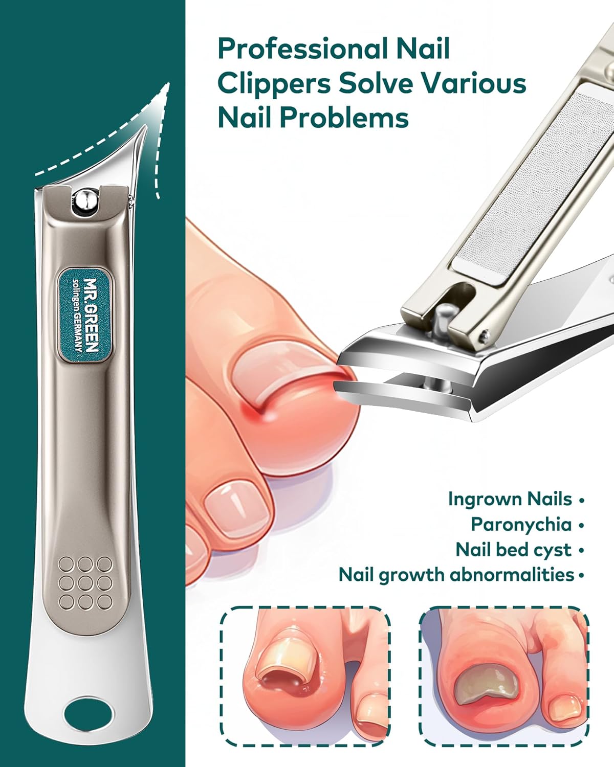 MR.GREEN Ingrown Nail Clippers, Slanted Curved Blade Nail Clippers for Ingrown Nails, Toenail Clippers for Thick Nails, Medical Grade Stainless Steel Professional fingernail Clippers For Men And Women - Image 4