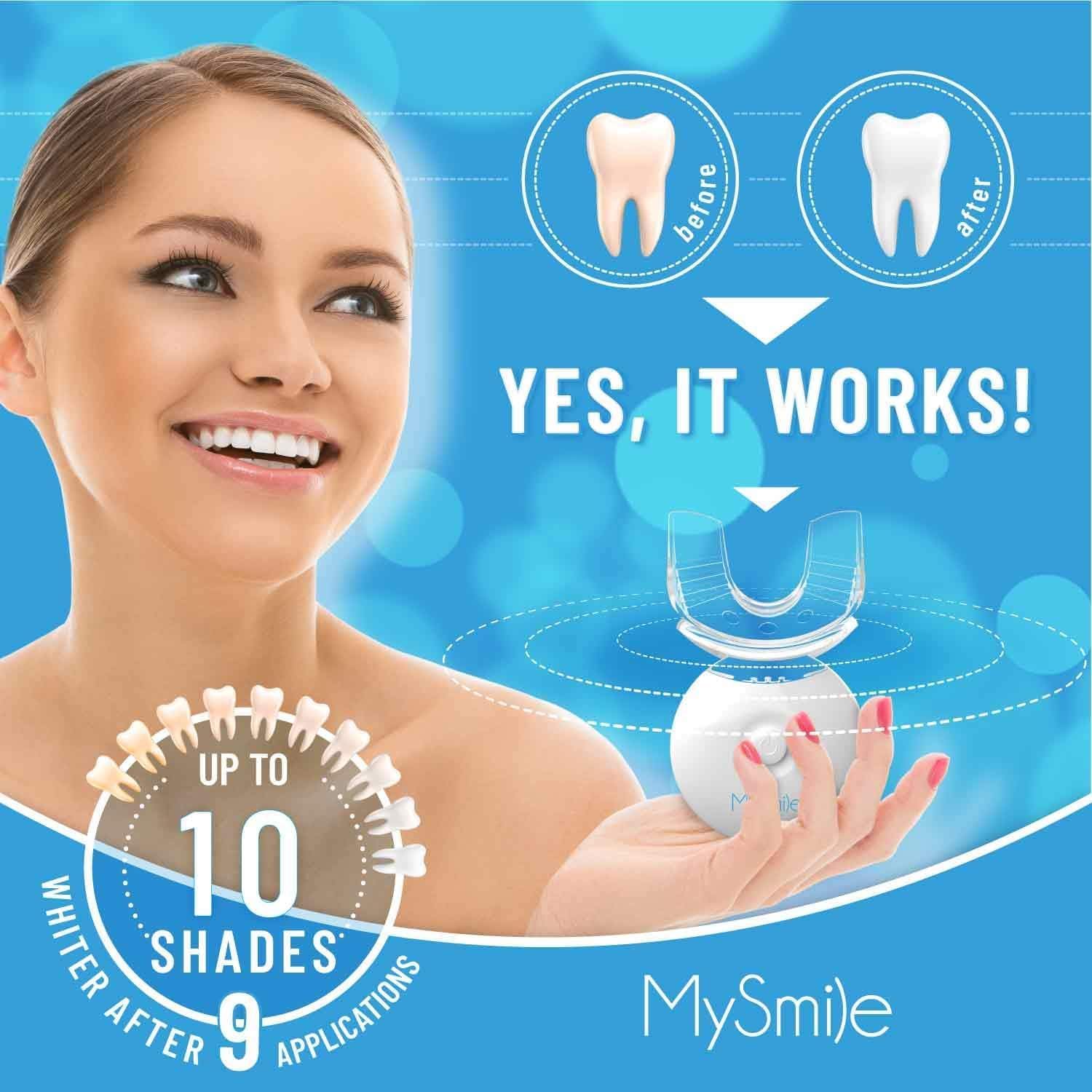MySmile Teeth Whitening Kit with LED Light, 10 Min Non-Sensitive Fast Teeth Whitener with 3 Carbamide Peroxide Whitening Gel, Helps to Remove Stains from Coffee, Smoking, Wines, Soda, Food - Image 2