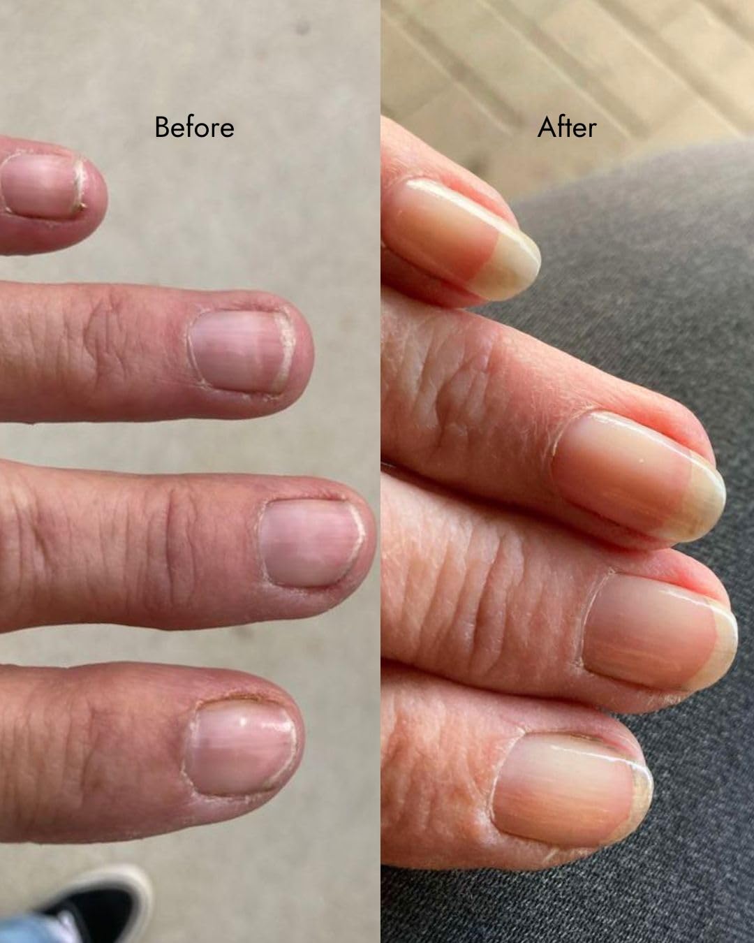 Natural Nail Strengthener Polish, Transparent Clear, Strengthening, Long-Lasting, Vegan & Cruelty-Free, 10ml – .34 fl oz. - Image 3