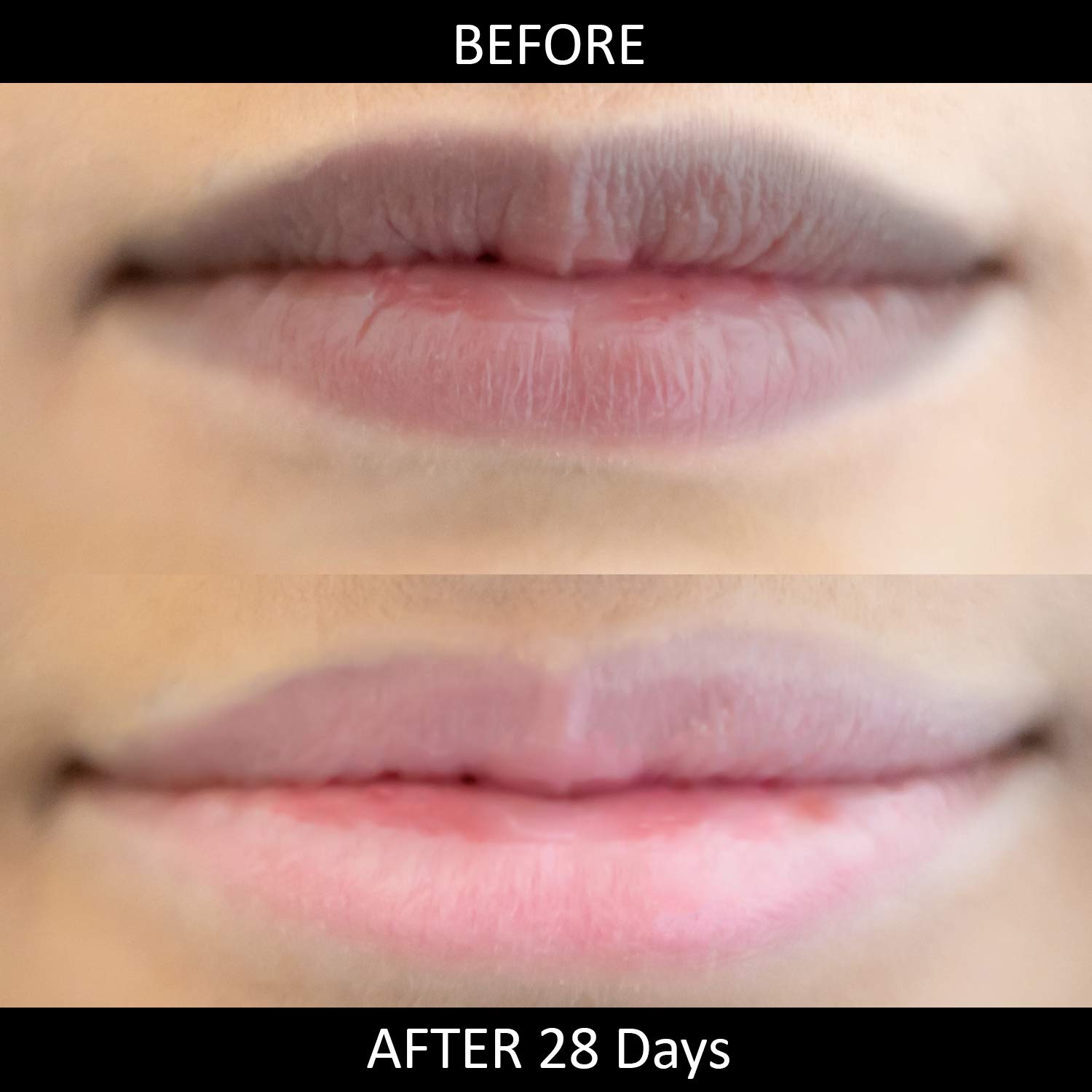 Omorfee 100% Organic Lip Lightening Stick for Dark Lips, Lip Whitening Lipstick with SPF, Natural Lip Balm Protection & Repair, Cocoa Butter, Carrot Seed Oil & Pineapple Extract - 6 Grams/0.21 Oz - Image 2