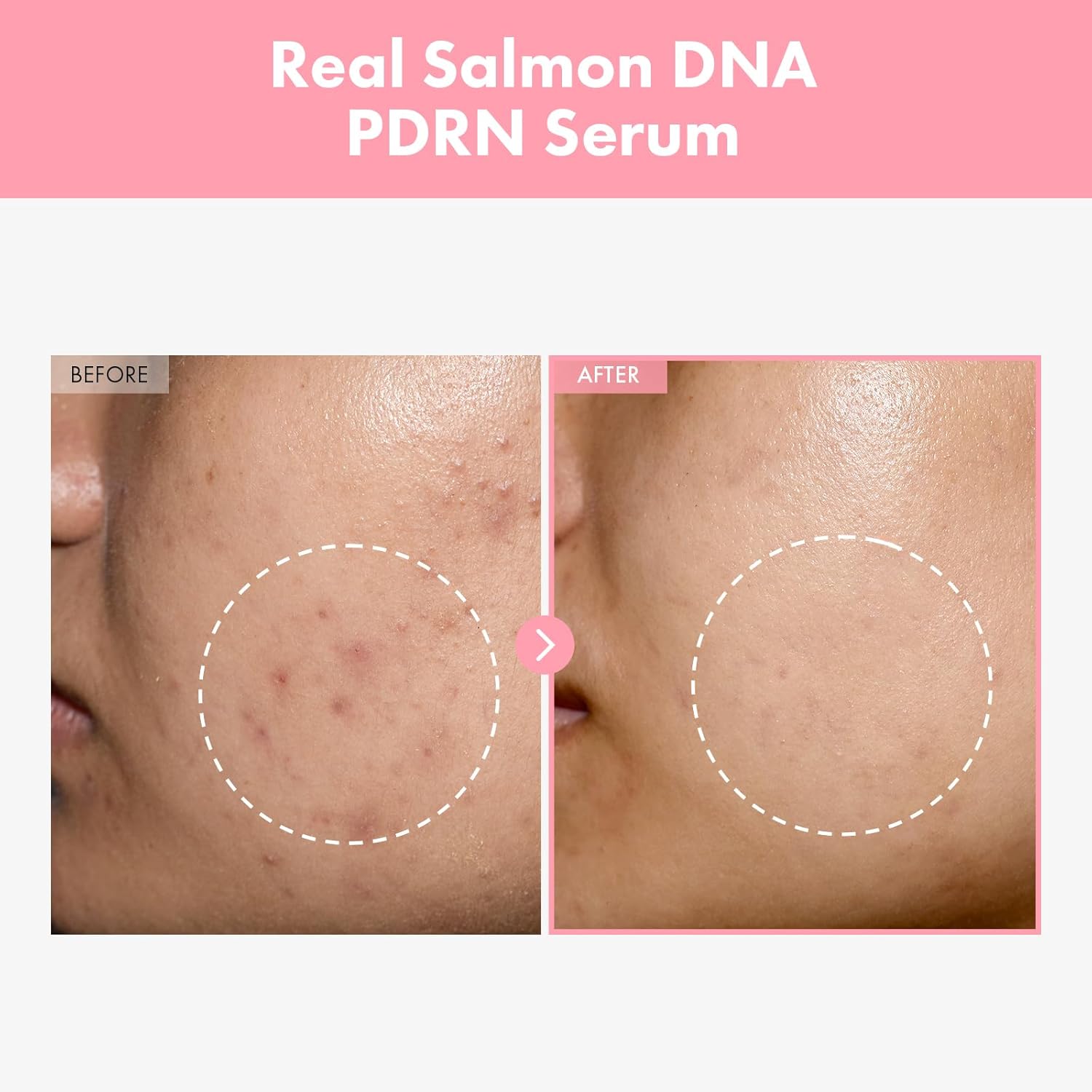 Pink Peptide 12 PDRN Serum With Salmon DNA PDRN 10,320ppm, 12 Peptides, Niacinamide, Skin glow, Hydrating, Moisturizing, Firming, Uneven Skin Tone, Korean Skincare, 33ml, 1.11 fl.oz. - Image 2
