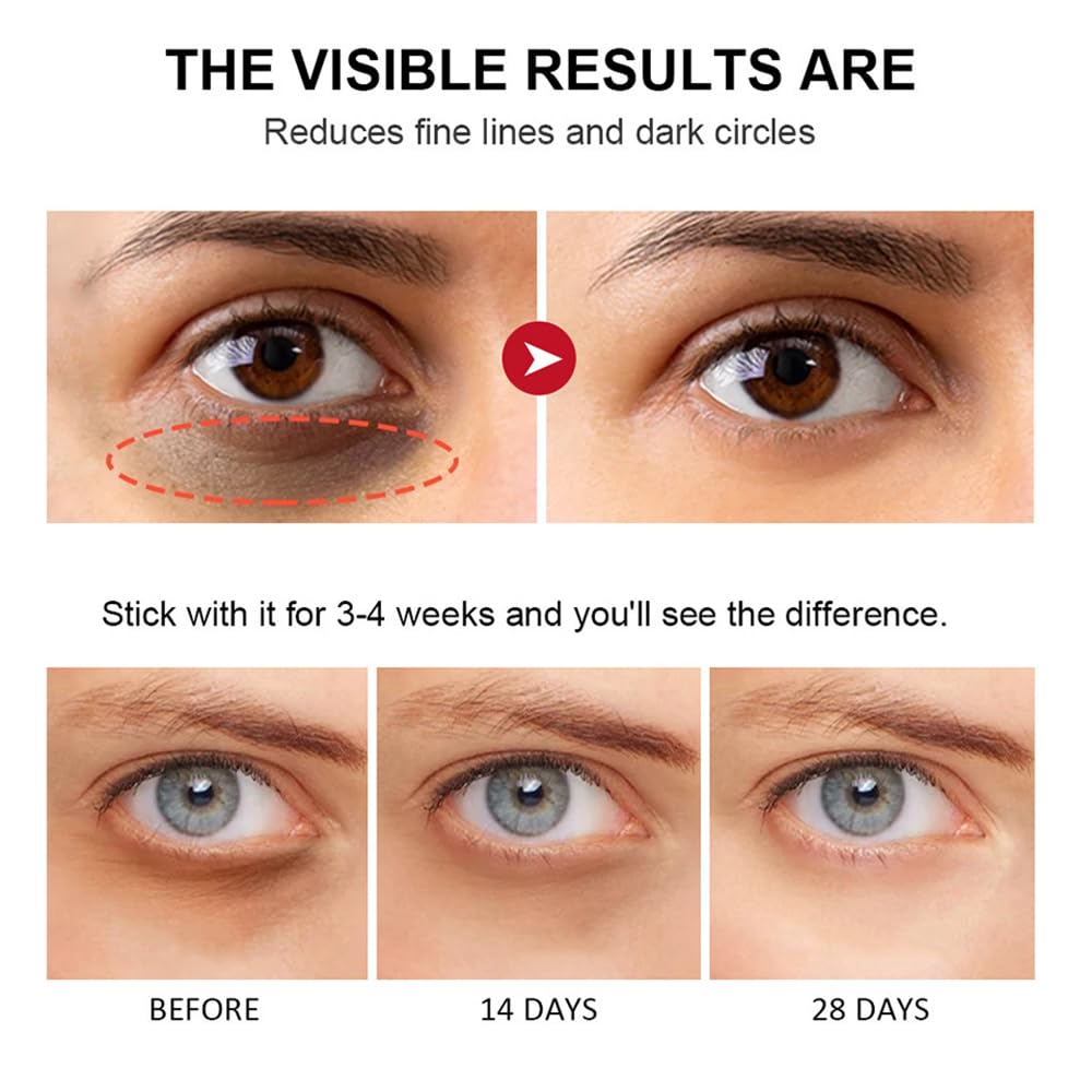 Retinol Eye Stick, Retinol Eye Cream With Collagen,Hyaluronic Acid For Dark Circle, Wrinkles, Under Eye Cream Anti Aging, Retinol Eye Balm Reduces Puffiness Fine Lines, Visible Results in 3-4 Weeks - Image 7