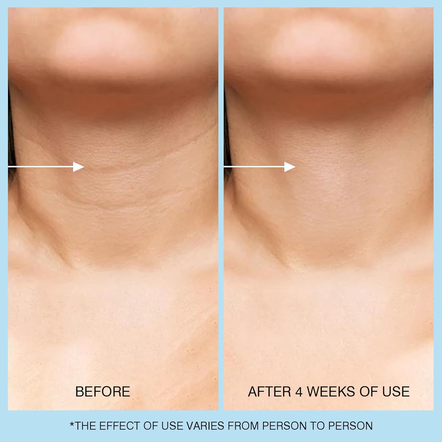 Retinol Neck Cream, Hyaluronic Acid and Caffeine Enriched Neck Firming Cream to Minimize Fine Lines & Dullness - 3-in-1 Moisturizing Cream for Neck, Chest and Face (50 ml/1.7 oz) - Image 5