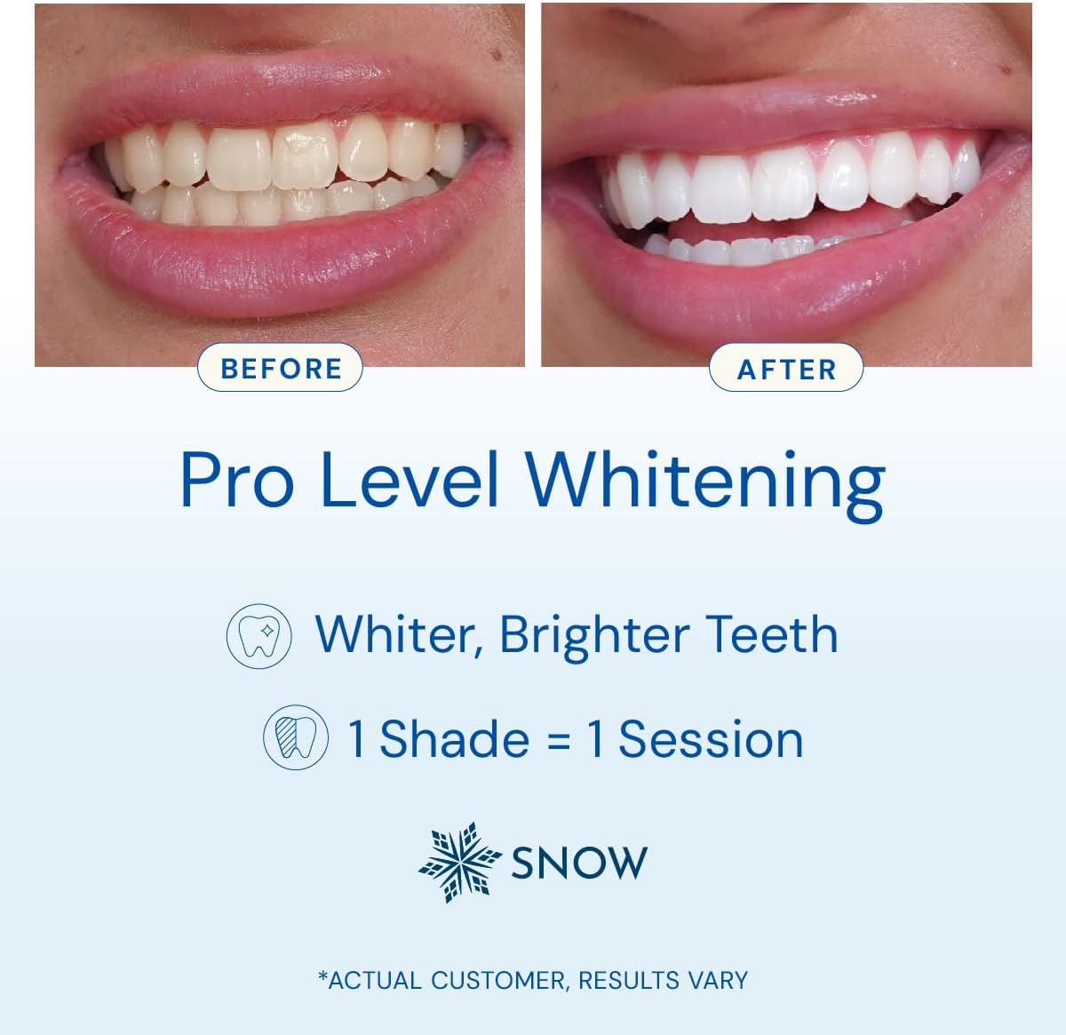 Snow Teeth Whitening Kit - Snow Teeth Whitening Serum and LED Mouthpiece Whitener, Formulated with Hydroxyapatite, Good for 6 Months - Wireless Kit with 3 Wands - Image 3