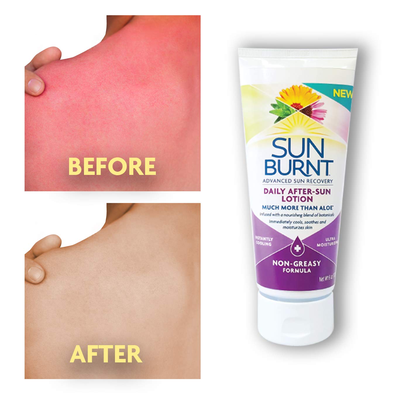 Sunburnt Advanced After-Sun Lotion, 6 Ounce - Image 4