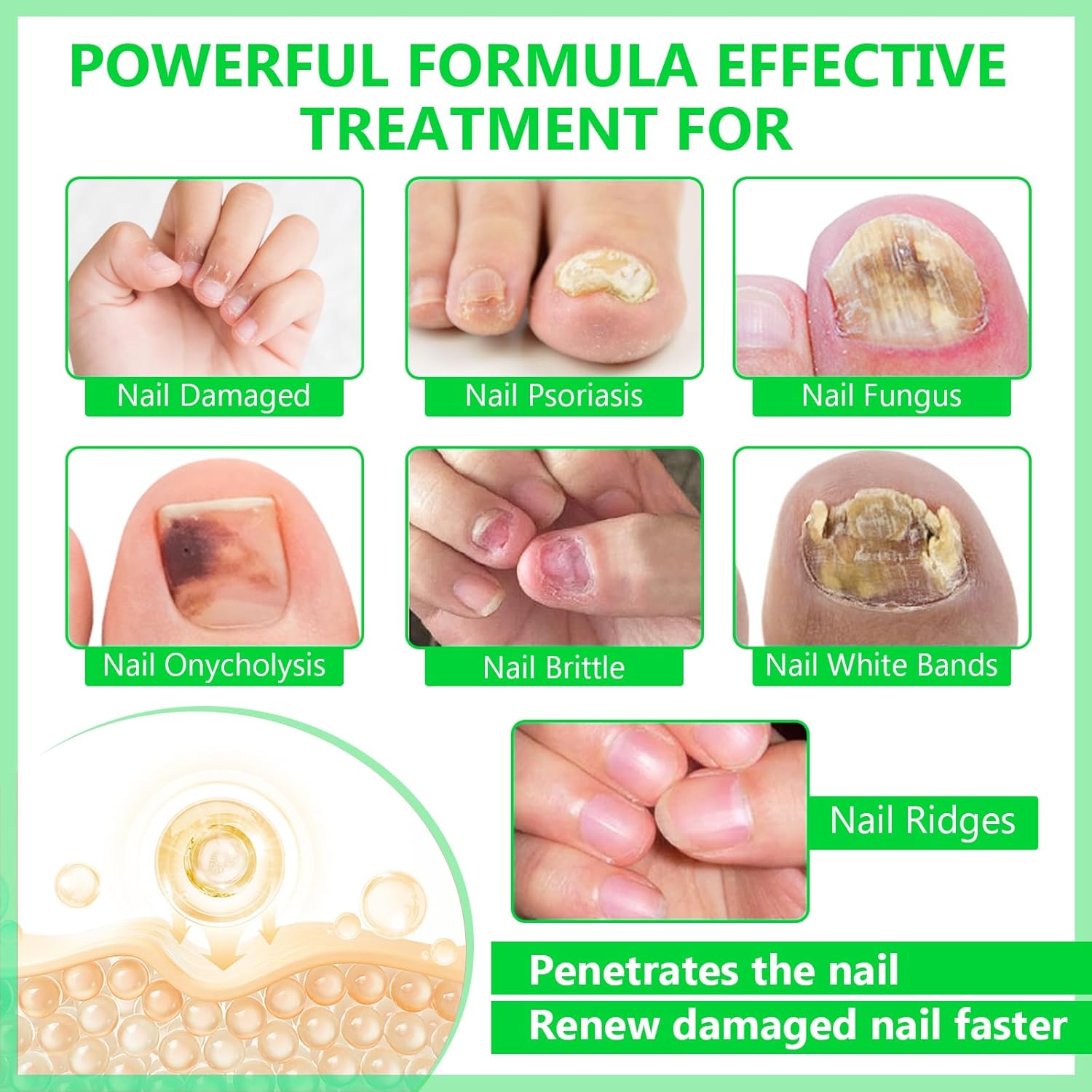 Toenail Fungus Treatment Extra Strength, Nail Treatments for Toenail with Naturally & Safely, Toe Nail Fungus Treatment Extra Strength for Thick, Broken, Discolored & Damaged Nail - Image 3