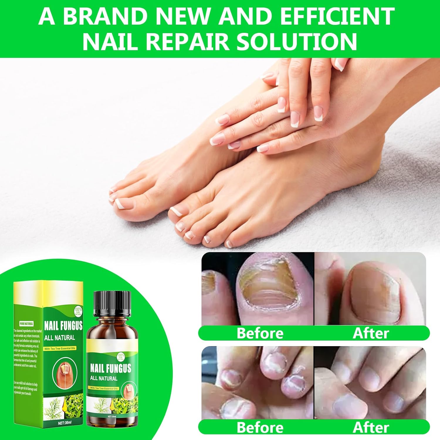 Toenail Fungus Treatment Extra Strength, Nail Treatments for Toenail with Naturally & Safely, Toe Nail Fungus Treatment Extra Strength for Thick, Broken, Discolored & Damaged Nail - Image 2