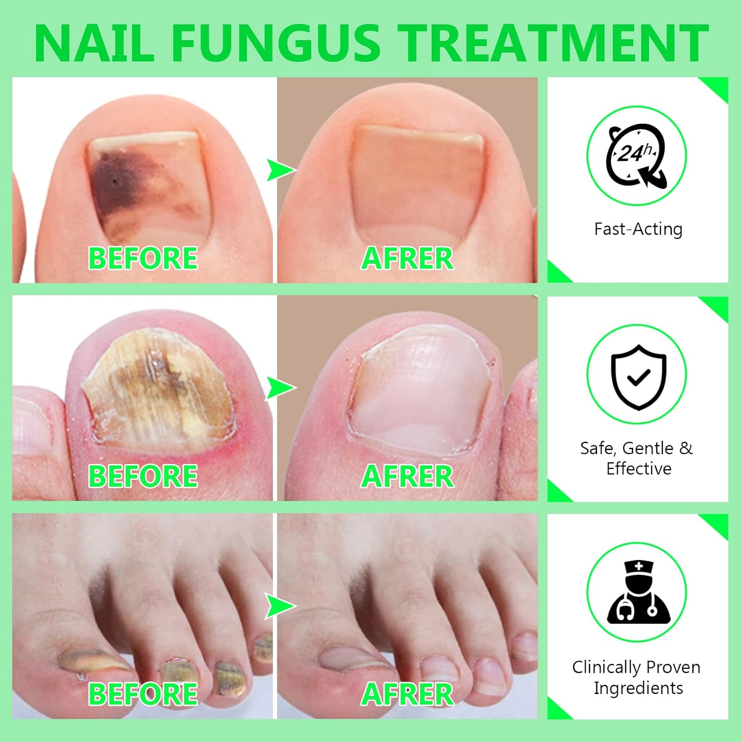 Toenail Fungus Treatment Extra Strength, Nail Treatments for Toenail with Naturally & Safely, Toe Nail Fungus Treatment Extra Strength for Thick, Broken, Discolored & Damaged Nail - Image 5