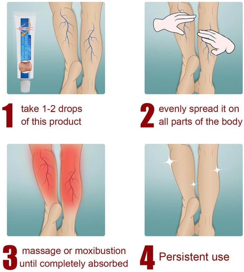 Vericose Veins Treatment Blue Light Lazer Treatment Pen,Spider Vein Treatment for Legs,Varicose Veins Blue Light Therapy Set - Image 8