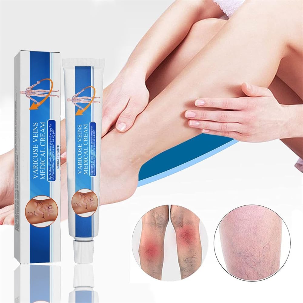 Vericose Veins Treatment Blue Light Lazer Treatment Pen,Spider Vein Treatment for Legs,Varicose Veins Blue Light Therapy Set - Image 2