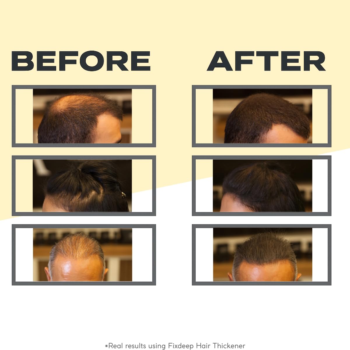 14g Black Hair Building Fibers Waterproof Sweat-Resistant for Thinning Hair Bald Spots and Gray Roots - Image 2