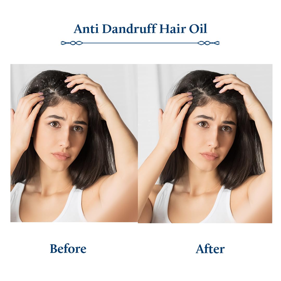Blue Nectar Tea Tree Oil for Hair & Scalp 3.38 Fl Oz Natural Anti-Dandruff Treatment - Image 4