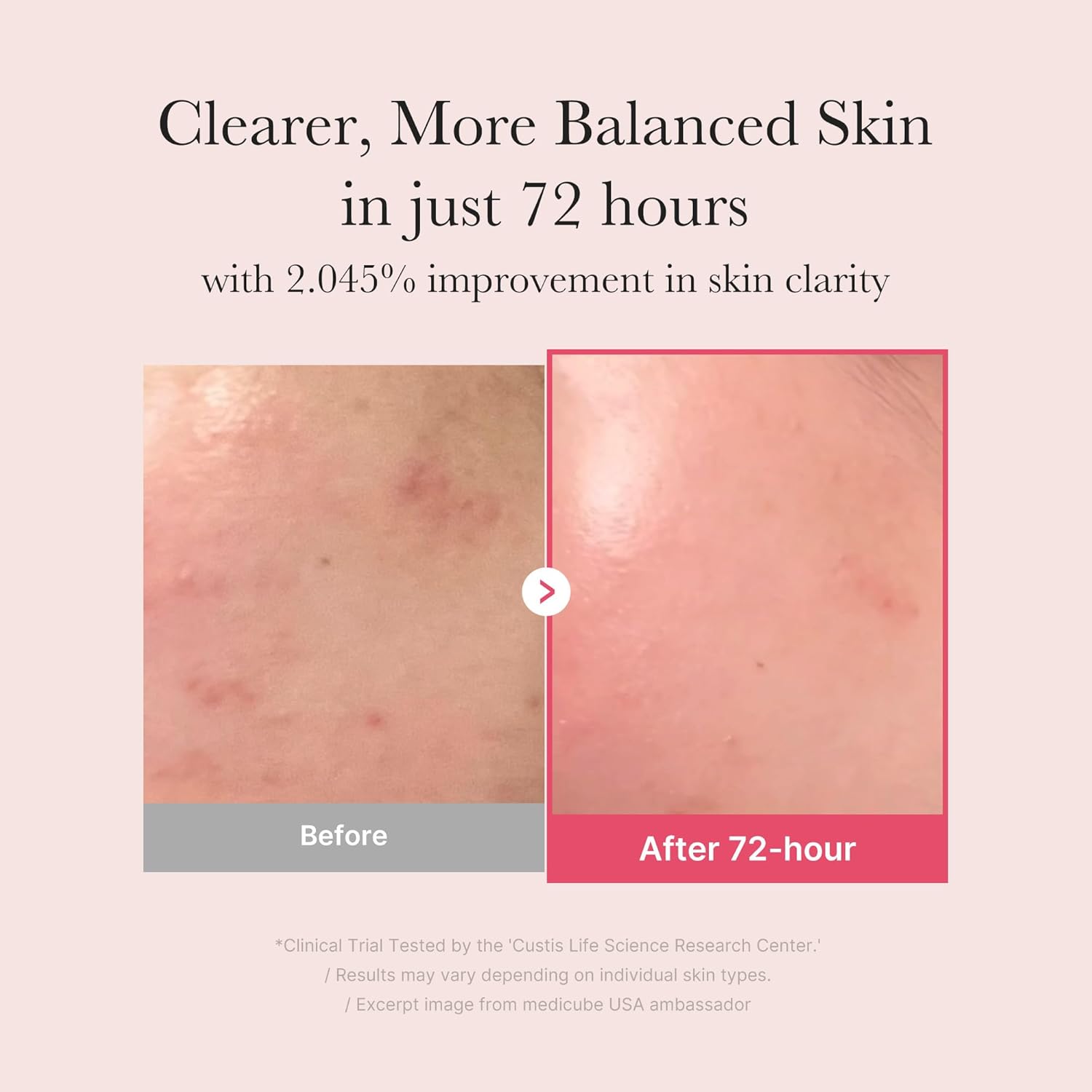 Medicube TXA+Niacinamide 15% Spot Care Glow Facial Serum, 1.01 fl oz, Korean Skincare - Image 3