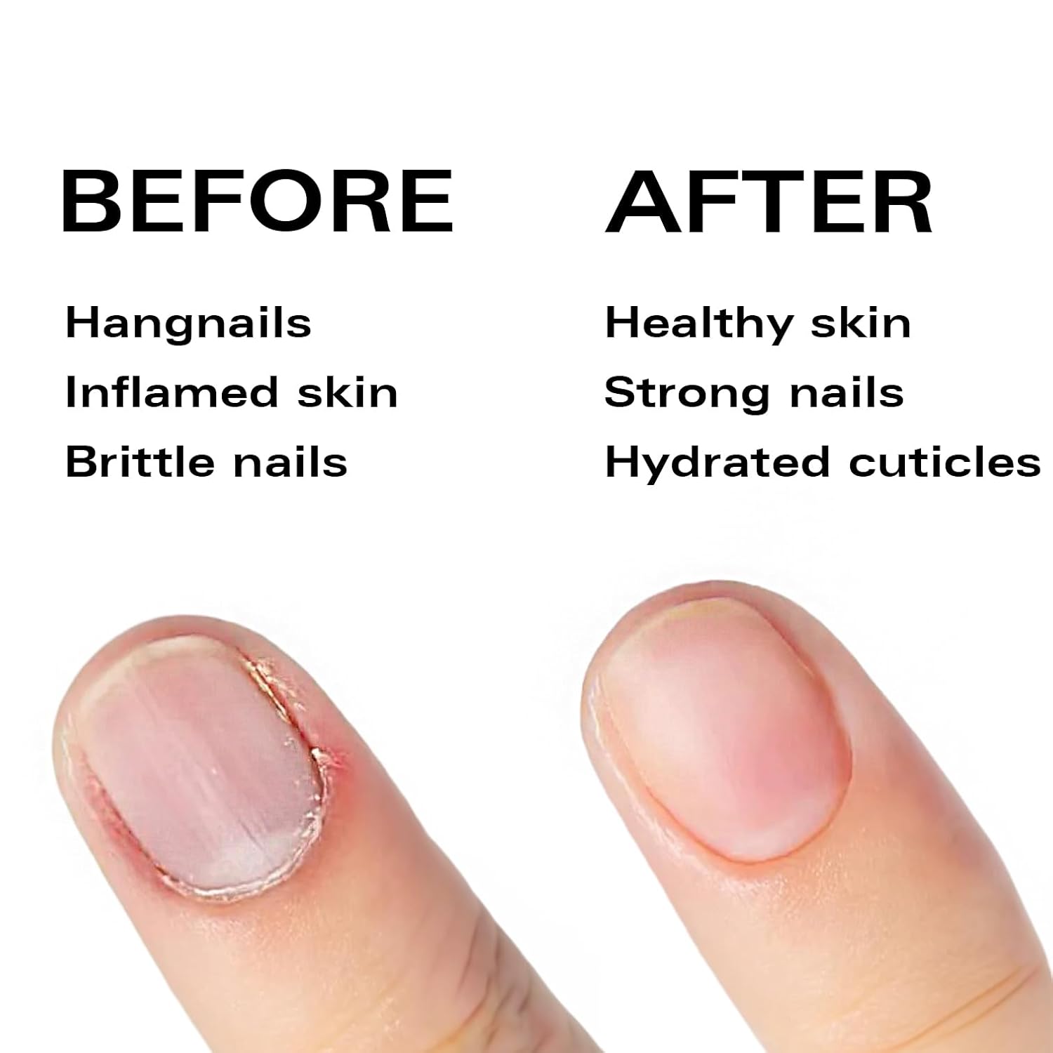 Nail Oil Cuticle Pen - Rose - 10ml Nail Strengthener & Growth Serum with Natural Oils - Image 8