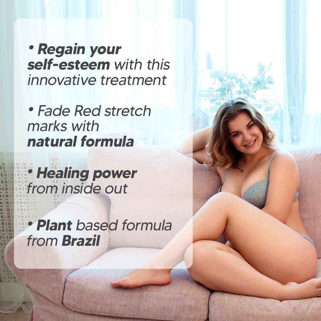 Cicatrissim Red Stretch Mark Removal Cream 100ml for All Skin Types - Image 3