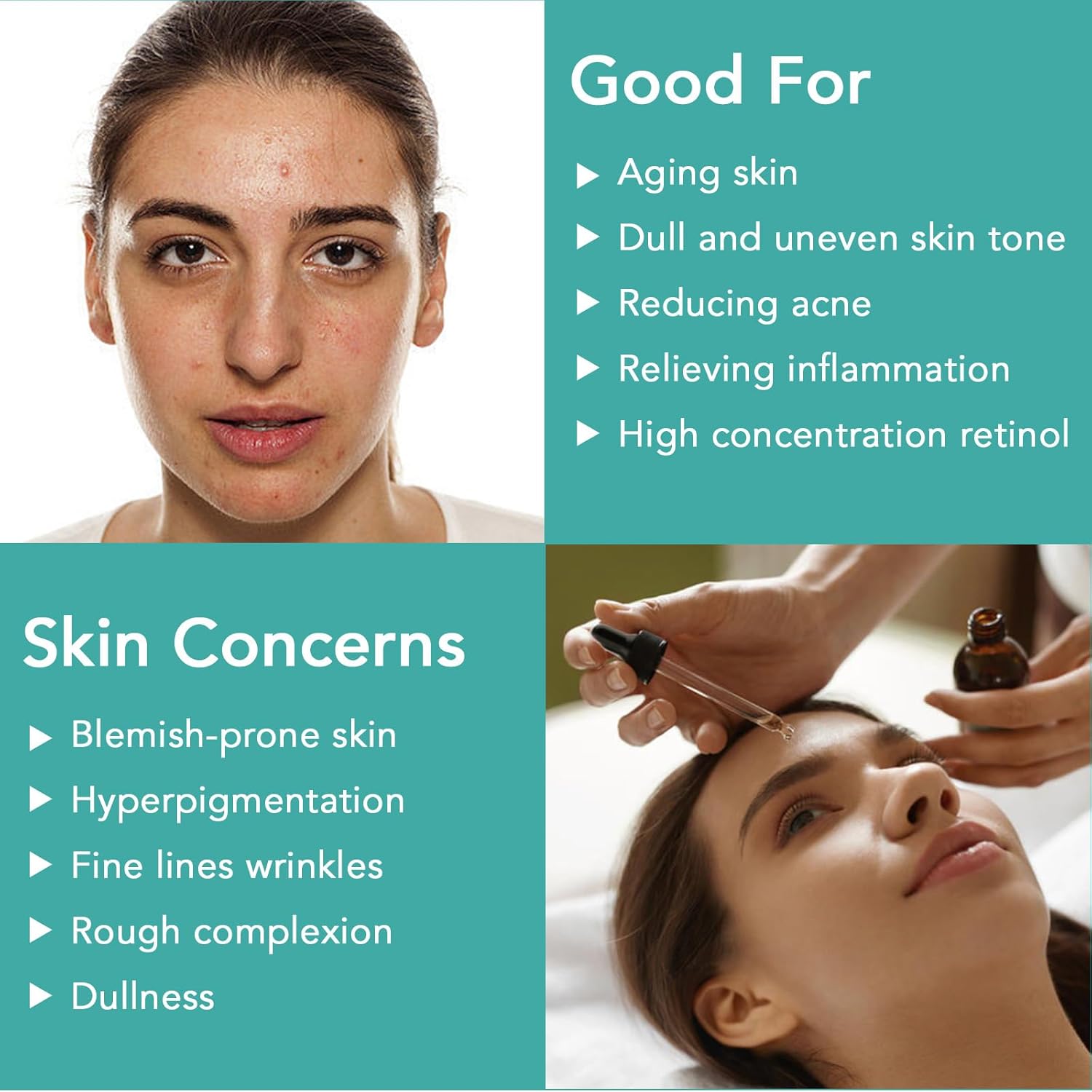 Retinol Anti-Aging Serum with Hyaluronic Acid, Vitamin E, Aloe - 1 oz - Image 3