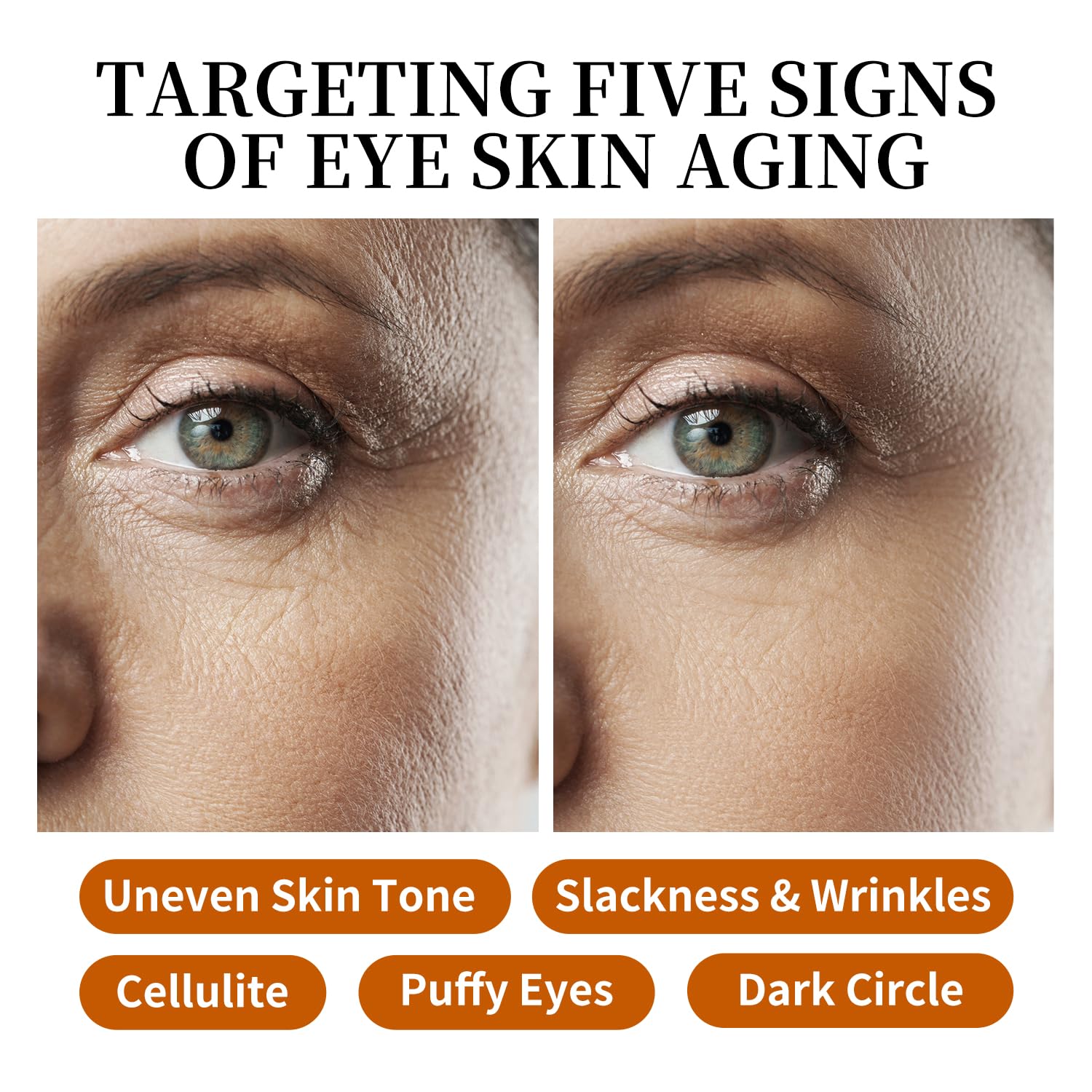 Retinol Vitamin C Anti-Aging Eye Cream and Serum Set for Sensitive Skin 30g 8ml - Image 9